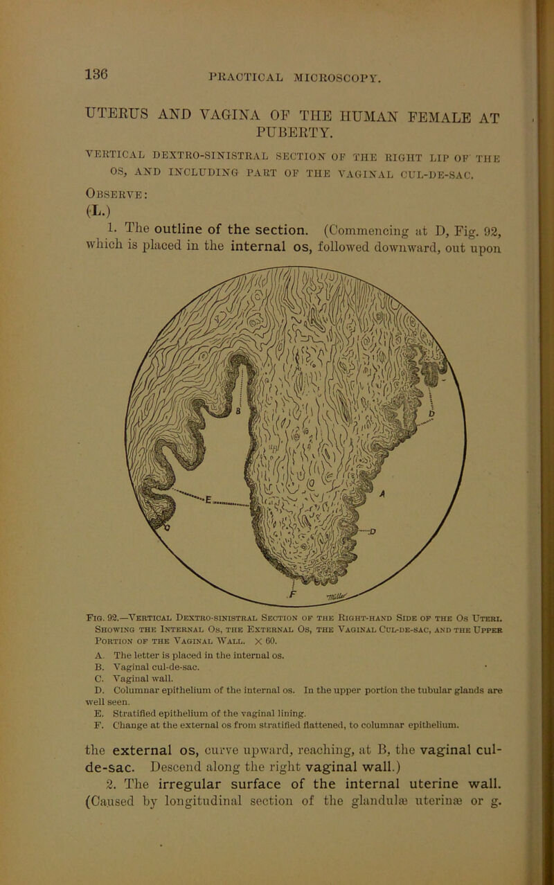 UTERUS AND VAGINA OP THE HUMAN FEMALE AT PUBERTY. VERTICAL DEXTRO-SINISTRAL SECTION OF THE RIGHT LIP OF THE OS, AND INCLUDING PART OF THE VAGINAL CUL-DE-SAC. Observe : (L.) 1. The outline of the section. (Commencing at D, Fig. 92, which is placed in the internal os, followed downward, out upon Fig. 92.—Vertical Dextro-sinistral Section of the Right-hand Side of the Os Uteri. Showing the Internal Os, the External Os, the Vaginal Cul-de-sac, and the Upper Portion of the Vaginal Wale, x 60. A. The letter is placed in the internal os. B. Vaginal cul-de-sac. C. Vaginal wall. D. Columnar epithelium of the internal os. In the upper portion the tubular glands are well seen. E. Stratified epithelium of the vaginal lining. F. Change at the external os from stratified flattened, to columnar epithelium. the external os, curve upward, reaching, at B, the vaginal cul- de-sac. Descend along the right vaginal wall.) 2. The irregular surface of the internal uterine wall. (Caused by longitudinal section of the glandular uteri use or g.