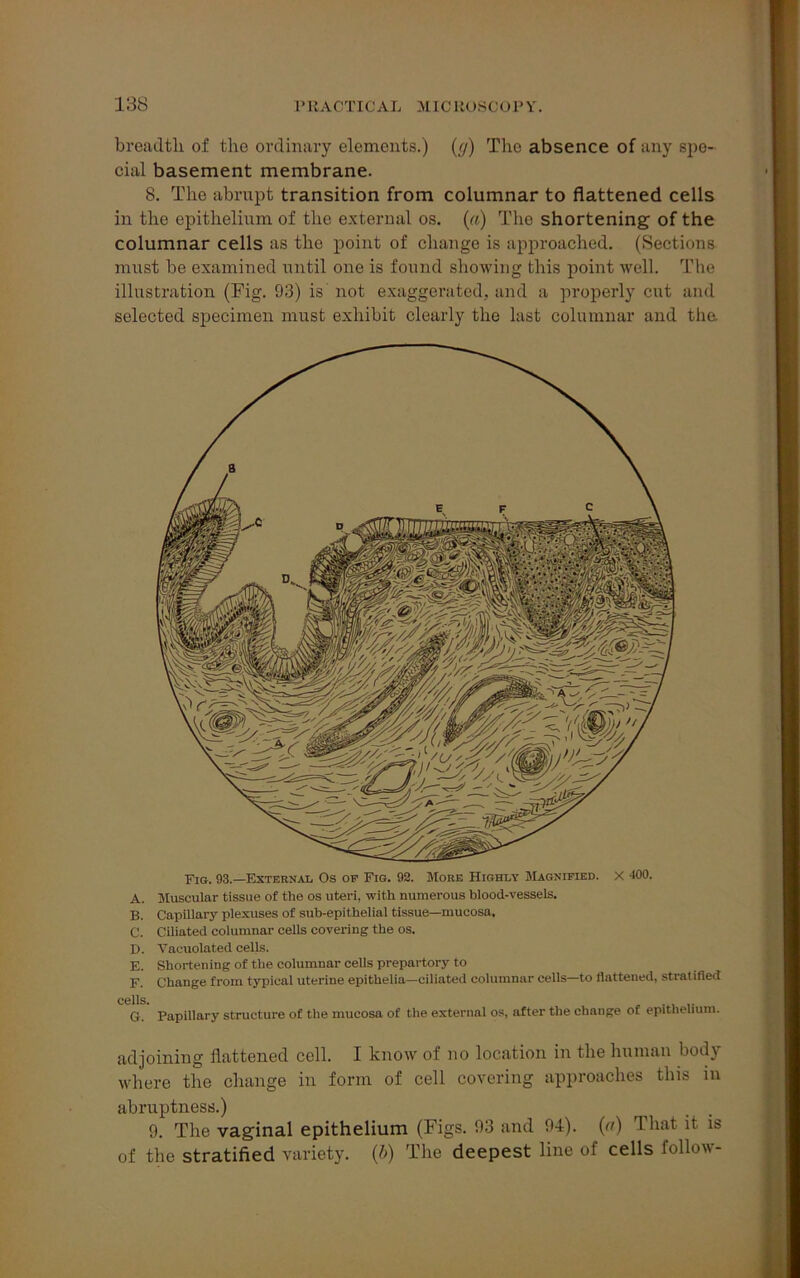 breadth of the ordinary elements.) (<j) The absence of any spe- cial basement membrane. 8. The abrupt transition from columnar to flattened cells in the epithelium of the external os. (a) The shortening of the columnar cells as the point of change is approached. (Sections must be examined until one is found showing this point well. The illustration (Fig. 93) is not exaggerated, and a properly cut and selected specimen must exhibit clearly the last columnar and tha Fig. 93.—External Os of Fib. 92. More Highly Magnified. X 400. A. Muscular tissue of the os uteri, with numerous blood-vessels. B. Capillary plexuses of sub-epithelial tissue—mucosa. C. Ciliated columnar cells covering the os. D. Vacuolated cells. E. Shortening of the columnar cells prepartory to F. Change from typical uterine epithelia—ciliated columnar cells—to flattened, stratified cells. G. Papillary structure of the mucosa of the external os, after the change of epithelium. adjoining flattened cell. I know of no location in the human body where the change in form of cell covering approaches this in abruptness.) 9. The vaginal epithelium (Figs. 93 and 94). (a) That it is of the stratified variety. (b) The deepest line of cells follow-
