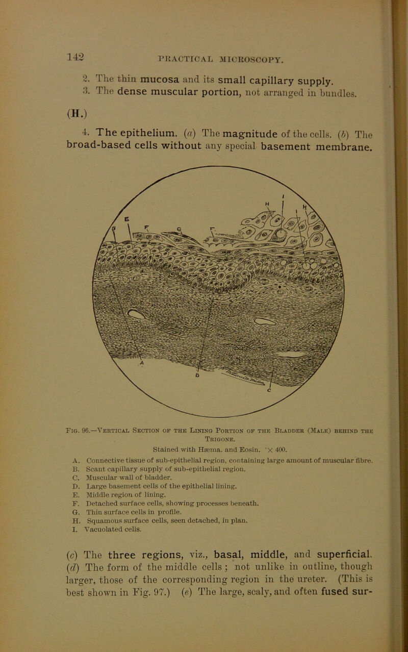 2. The thin mucosa and its small capillary supply. 3. The dense muscular portion, not arranged in bundles. (H.) 4. The epithelium, (a) The magnitude of the cells, (b) The broad-based cells without any special basement membrane. Fig. 96.—Vertical Section op the Lining Portion op the Bladder (Male) behind the Trigone. Stained with Hanna, and Eosin. x 400. A. Connective tissue of sub-epithelial region, containing large amount of muscular fibre. B. Scant capillary supply of sub-epithelial region. C. Muscular wall of bladder. D. Large basement cells of the epithelial lining. E. Middle region of lining. F. Detached surface cells, showing processes beneath. G. Thin surface cells in profile. H. Squamous surface cells, seen detached, in plan. I. Vacuolated cells. (c) The three regions, viz., basal, middle, and superficial. (cl) The form of the middle cells ; not unlike in outline, though larger, those of the corresponding region in the ureter. (This is best shown in Fig. 97.) (e) The large, scaly, and often fused sur-
