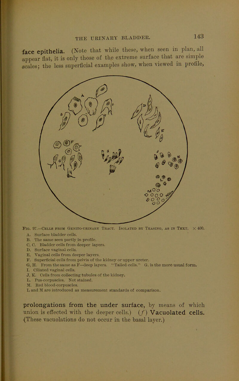 face epithelia. (Note that while these, when seen in plan, all appear flat, it is only those of the extreme surface that are simple scales; the less superficial examples show, when viewed in piofile, Fig. 97.—Cells from Genito-urinary Tract. Isolated by Teasing, as in Text. X 400. A. Surface bladder cells. B. The same seen partly in profile. C. C. Bladder cells from deeper layers. D. Surface vaginal cells. E. Vaginal cells from deeper layers. F. Superficial cells from pelvis of the kidney or upper ureter. G. H. From the same as F—deep layers. “Tailed cells.” G. is the more usual form. I. Ciliated vaginal cells. J, K. Cells from collecting tubules of the kidney. L. Pus-corpuscles. Not stained. M. Red blood-corpuscles. L and M are introduced as measurement standards of comparison. prolongations from the under surface, by means of which union is effected with the deeper cells.) (/) Vacuolated cells. (These vacuolations do not occur in the basal layer.)