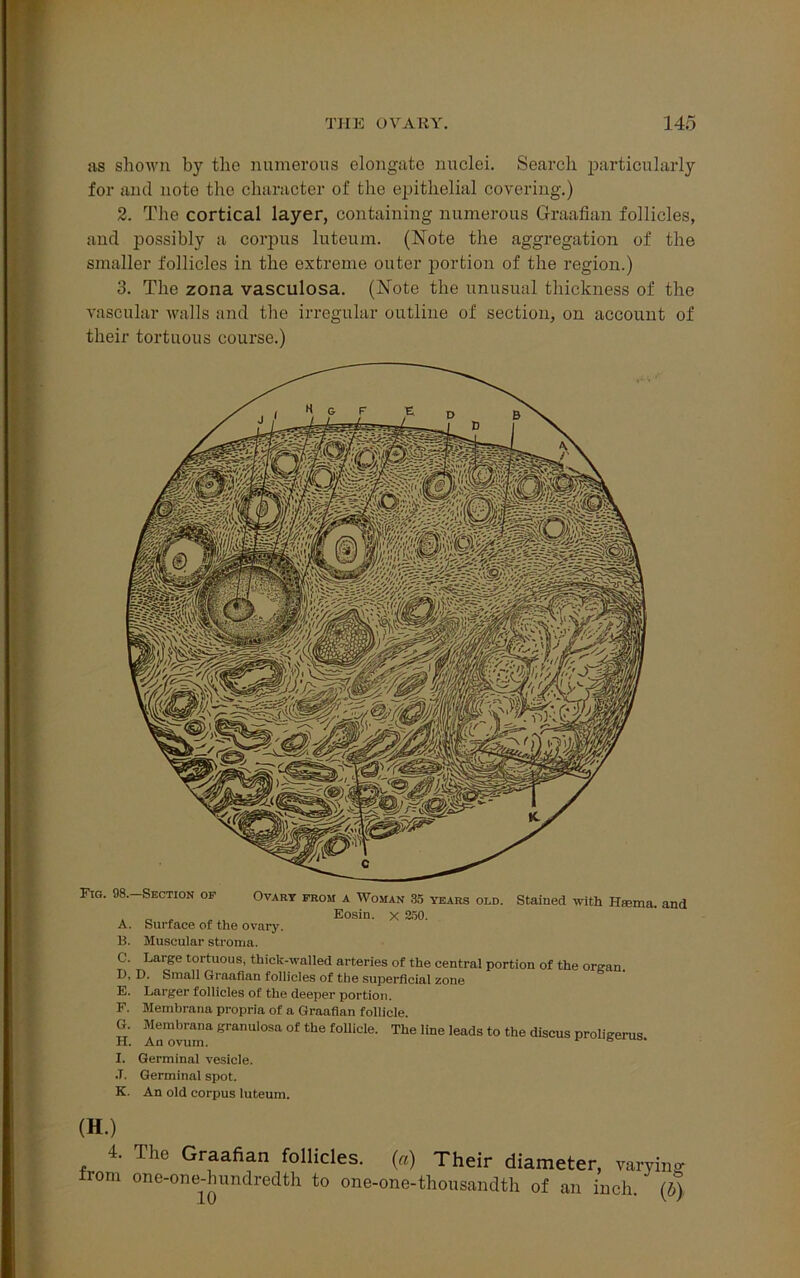 as shown by the numerous elongate nuclei. Search particularly for and note the character of the epithelial covering.) 2. The cortical layer, containing numerous Graafian follicles, and possibly a corpus luteum. (Note the aggregation of the smaller follicles in the extreme outer portion of the region.) 3. The zona vasculosa. (Note the unusual thickness of the vascular walls and the irregular outline of section, on account of their tortuous course.) Fig. 98. Section of Ovary from a Woman 35 years old. Stained with ifema. and _ „ Eosin. x S50. A. Surface of the ovary. B. Muscular stroma. C. Large tortuous, thick-walled arteries of the central portion of the organ. D. D. Small Graafian follicles of the superficial zone E. Larger follicles of the deeper portion. F. Membrana propria of a Graafian follicle. G. Membrana granulosa of the follicle. The line leads to the discus proligerus H. An ovum. r & I. Germinal vesicle. J. Germinal spot. K. An old corpus luteum. (H.) 4. from The Graafian follicles, (a) Their diameter, varying one-one-hundredth to one-one-thousandth of an inch, (d)