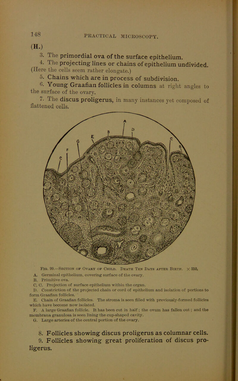 (H.) 3. The primordial ova of the surface epithelium. 4. Tlie projecting lines or chains of epithelium undivided. (Here the cells seem rather elongate.) o. Chains which are in process of subdivision. G. Young Graafian follicles in columns at right angles to the surface of the ovary. 7. The discus proligerus, in many instances yet composed of flattened cells. Fig. 99.—Section op Ovary of Child. Death Ten Days after Birth, x 350. A. Germinal epithelium, covering surface of the ovary. B. Primitive ova. C. C. Projection of surface epithelium within the organ. D. Constriction of the projected chain or cord of epithelium and isolation of portions to form Graafian follicles. ' E. Chain of Graafian follicles. The stroma is seen filled with previously-formed follicles which have become now isolated. F. A large Graafian follicle. It has been cut in half ; the ovum has fallen out; and the membrana granulosa is seen lining the cup-shaped cavity. G. Large arteries of the central portion of the ovary. 8. Follicles showing discus proligerus as columnar cells. 9. Follicles showing great proliferation of discus pro- ligerus.