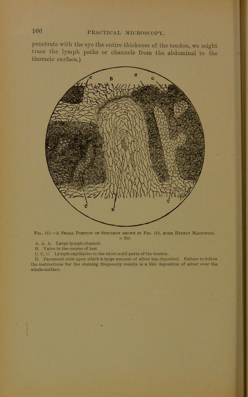 penetrate with the eye the entire thickness of the tendon, we might trace the lymph paths or channels from the abdominal to the thoracic surface.) Fig. 111.—A Small Portion of Specimen shown in Fig. 110, more Highly Magnified. X 350. A, A, A. Large lymph-channel. B. Valve in the course of last. C, C, 0. Lymph-capillaries in the more solid parts of the tendon. D. Pavement cells upon which U large amount of silver has deposited. Failure to follow the instructions for the staining frequently results in a like deposition of silver over the whole surface.
