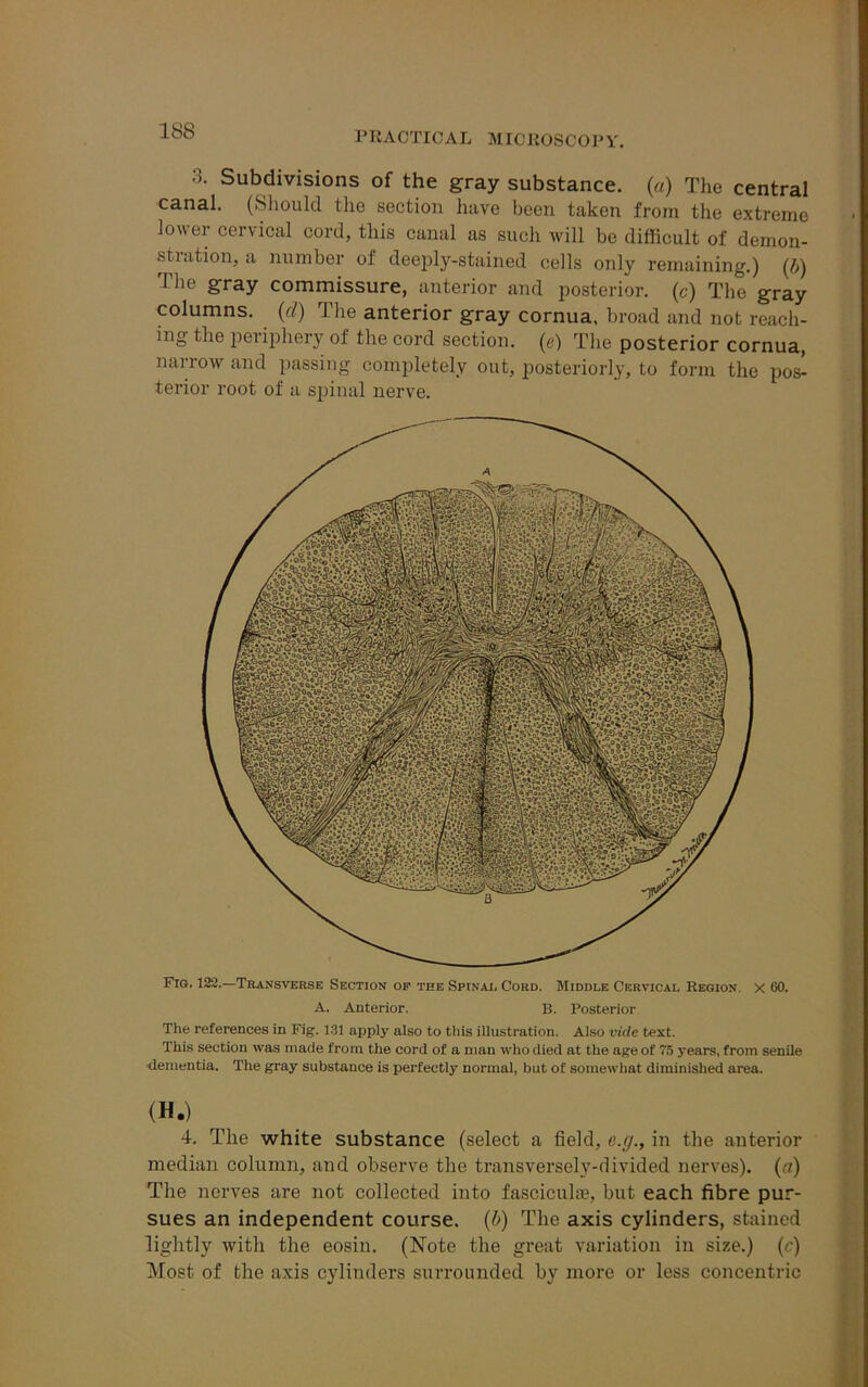 3. Subdivisions of the gray substance, (a) The central canal. (Should the section have been taken from the extreme lower cervical cord, this canal as such will be difficult of demon- stiation, a number of deeply-stained cells only remaining.) (/;) The gray commissure, anterior and posterior, (c) The gray columns, (d) The anterior gray cornua, broad and not reach- ing the periphery of the cord section, (e) The posterior cornua, narrow and passing completely out, posteriorly, to form the pos^ terior root of a spinal nerve. k&m IrPj/'J.Q -' i v ' , 1 Jll8piip maomi Fig. 122.—Transverse Section of the Spinai, Cord. Middle Cervical Region X 60. A. Anterior. B. Posterior The references in Fig. 131 apply also to this illustration. Also vide test. This section was made from the cord of a man who died at the age of 75 years, from senile dementia. The gray substance is perfectly normal, but of somewhat diminished area. (H.) 4. The white substance (select a field, c.g., in the anterior median column, and observe the transversely-divided nerves), (a) The nerves are not collected into fascicule, but each fibre pur- sues an independent course. (b) The axis cylinders, stained lightly with the eosin. (Note the great variation in size.) (c) Most of the axis cylinders surrounded by more or less concentric