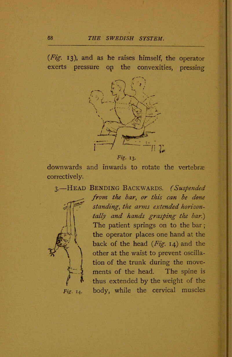 I 68 THE SWEDISH SYSTEM. {Fig. 13), and as he raises himself, the operator exerts pressure op the convexities, pressing downwards and inwards to rotate the vertebrae correctively. 3.—Head Bending Backwards. (Suspended from the bar, or this can be done standing, the arms extended horizon- tally and hands grasping the bar.) The patient springs on to the bar; the operator places one hand at the back of the head (Fig. 14) and the other at the waist to prevent oscilla- tion of the trunk during the move- ments of the head. The spine is thus extended by the weight of the body, while the cervical muscles