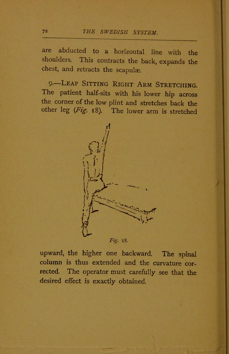 are abducted to a horizontal line with the shoulders. This contracts the back, expands the chest, and retracts the scapulae. 9-—Leap Sitting Right Arm Stretching. The patient half-sits with his lower hip across the corner of the low plint and stretches back the other leg (Fig-. 18). The lower arm is stretched upward, the higher one backward. The spinal column is thus extended and the curvature cor- rected. The operator must carefully see that the desired effect is exactly obtained.