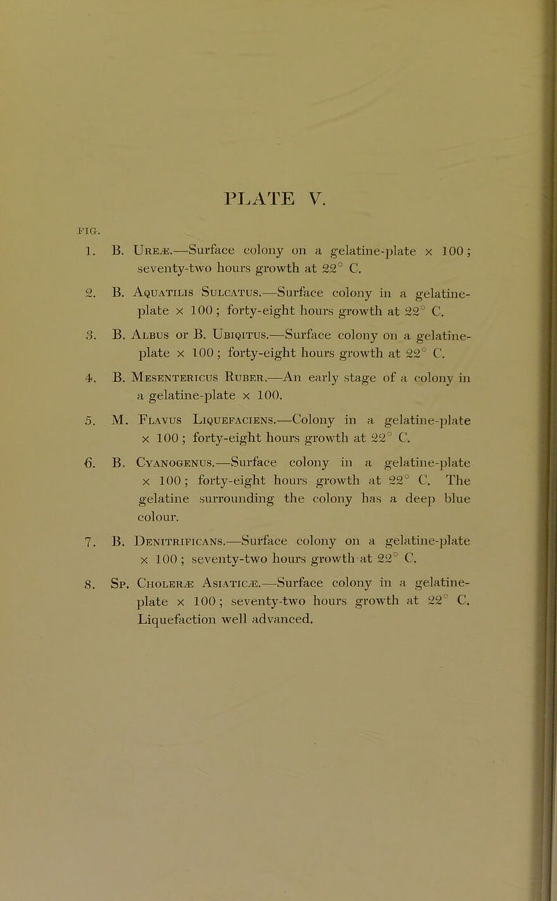 VIG. 1. B. Ure^.—Surface colony on a gelatine-plate x 100; seventy-two hours growth at 22° C. 2. B. Aquatilis Sulcatus.—Surface colony in a gelatine- plate X 100 ; forty-eight houi-s growth at 22° C. 3. B. Albus or B. Ubiqitus.—Surface colony on a gelatine- plate X 100 ; forty-eight hours growth at 22° C. 4. B. Mesentericus Ruber.—An early stage of a c-olony in a gelatine-plate x 100. 5. M. Flavus Liquefaciens.—Colony in a gelatine-])late X 100 ; forty-eight hours growth at 22° C. 6. B. Cyanogenus.—Surface colony in a gelatine-))late X 100; forty-eight hours growth at 22° C. The gelatine surrounding the colony has a deej) blue colour. 7. B. Denitrificans.—Surface colony on a gelatine-jdate X 100; seventy-two hours growth at 22° C. 8. Sp. Choler.® AsiaticvE.—-Surface colony in a gelatine- plate X 100; seventy-two hours growth at 22° C. Liquefaction well advanced.
