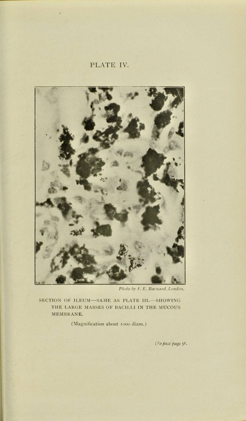 Photo by F. E. Barnard, London. SECTION OF ILEUM—SAME AS PLATE III.—SHOWING THE LARGE MASSES OF BACILLI IN THE MUCOUS MEMBRANE. (Magnification about 1000 diam.)