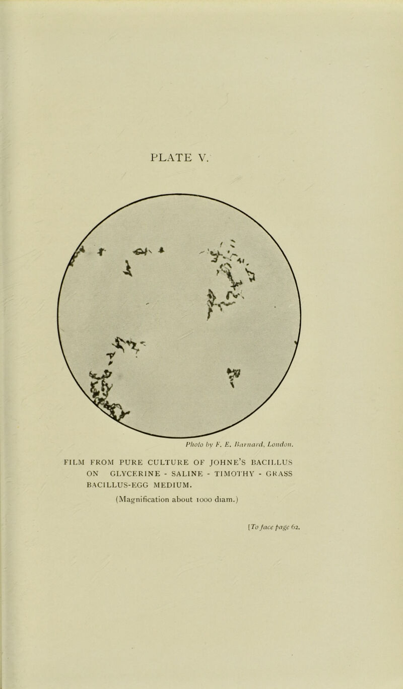 Photo by F. E. Barnard, London. FILM FROM PURE CULTURE OF JOHNE’S BACILLUS ON GLYCERINE - SALINE - TIMOTHY - GRASS BACILLUS-EGG MEDIUM. (Magnification about 1000 diam.)