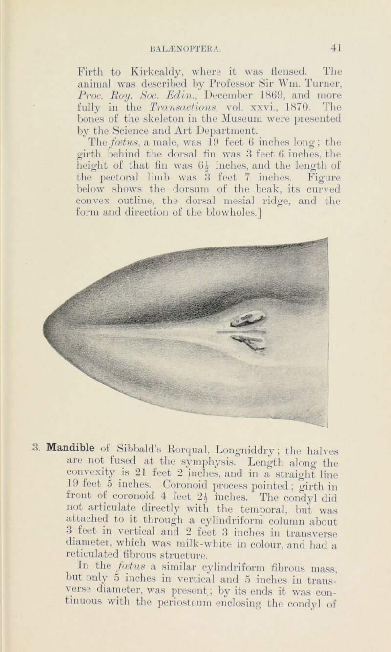 Firth to Kirkcaldy, where it was flensed. The aiiiiiial was descril^ed by Professor Sir Win. 'Ihirner, Proc. Roy. Roc. Edln., December 1869, and more fully in tlie Transactions, vol. xxvi., 1870. The bones of the skeleton in the Museum were presented by the Science and Art Department. T\\ki foetus, a male, was 19 feet 6 inches lonoy the oirth behind the dorsal fin was 8 feet 6 inches, the heiolit of that hn was 64 inches, and the lenoth of the pectoral limb was 8 feet 7 inches. Figure below shows the dorsum of the beak, its curved convex outline, the dorsal mesial ridge, and the form and direction of the blowholes.] 8. Mandible of Sibbald’s Ror(|ual, Longniddry; the halves are not fused at the symphysis. Lengtli along the convexity is 21 feet 2 inches, and in a straight line 19 feet 5 inches. Coronoid process pointed ; girth in front of coronoid 4 feet 2^ inches. The condyl did not articulate directly with the temporal, but was attached to it through a cylindriform column about 8^ feet in vertical and 2 feet 8 inches in transverse diameter, which was milk-white in colour, and had a reticulated fibrous structure. In the fetus a similar cylindriform fibrous mass, but oidy 5 inches in vertical and 5 inches in trans- verse diameter, was })resent; by its ends it was con- tinuous with the periosteum enclosing the condyl of