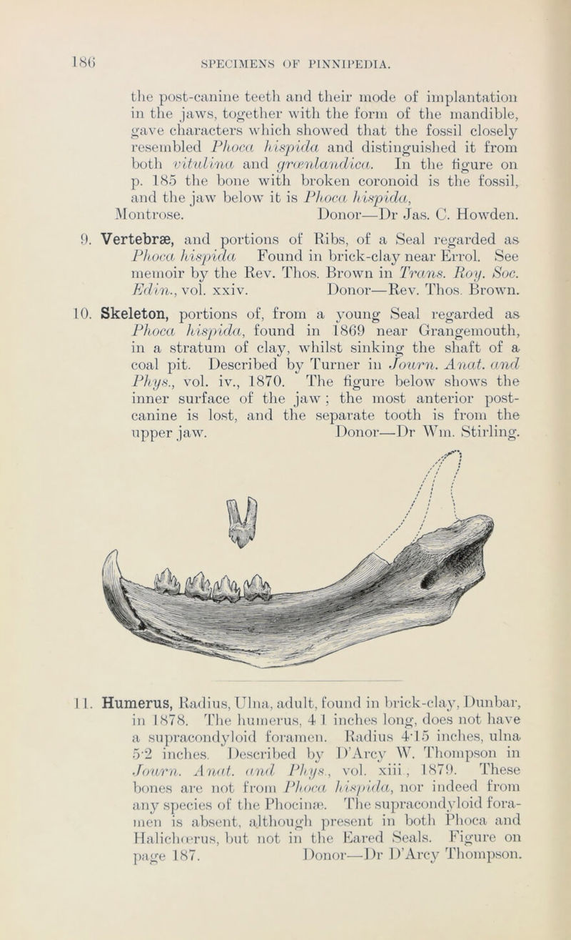 tlie post-canine teetli and their inode of implantation in the jaws, too-ether with the form of tlie mandible, oave characters which showed that the fossil closely resembled Pkoca luspida and distinguished it from both vitidina and (jramlandica. In the figure on p. 1(S5 the bone with broken coronoid is the fossil, and the jaw below it is Fhoca Jiispida, JMontrose. Donor—Dr Jas. C. Howden. 9. Vertebrae, and portions of Ribs, of a Seal regarded as Pliorxt hispida Found in brick-clay near Errol. See memoir by the Rev. Thos. Brown in Trans. Roy. Soc. Edin., vol. xxiv. Donor—Rev. Thos. Brown. 10. Skeleton, portions of, from a young Seal regarded as Pkoca hispida, found in 1869 near Grangemouth, in a stratum of clay, whilst sinking the shaft of a coal pit. Described by Turner in Journ. Anat. and Phys., vol. iv., 1870. The figure below shows the inner surface of the jaw ; the most anterior post- canine is lost, and the separate tooth is from the upper jaw. Donor—Dr Win. Stirling. 1 1. Humerus, Radius, Ulna, adult, found in brick-clay, Dunbar, in 1878. The humerus, 4 1 inches long, does not have a supracondyloid foramen. Radius 4d5 inches, ulna 5'2 inches. Described by D’Arcy W. Thompson in Journ. Anat. and Phps., vol. xiii , 1879. These bones are not from Phoca hispala, nor indeed from any species of the Bhocime. Tlie supracondyloid fora- men is absent, although present in both Phoca and Halicluerus, but not in the Eared Seals. Figui*e on page 187. Donor—Dr D’Arcy Thompson.
