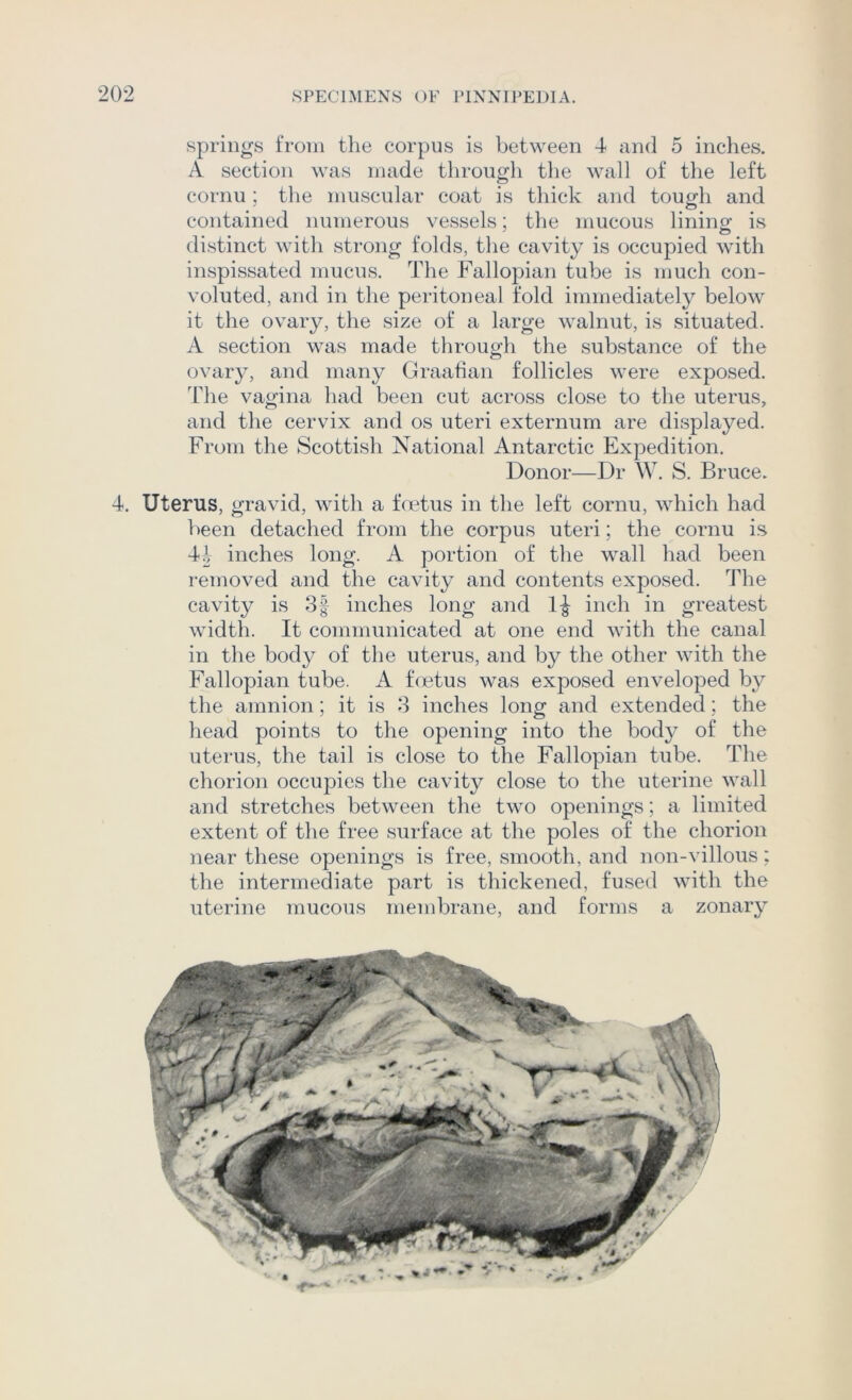springs from the corpus is between 4 and 5 inches. A section was made through the wall of the left cornu ; the muscular coat is thick and tough and contained numerous vessels; the mucous lining is distinct with strong folds, the cavity is occupied with inspissated mucus. The Fallopian tube is much con- voluted, and in the peritoneal fold immediately below it the ovary, the size of a large walnut, is situated. A section was made through the substance of the ovary, and many Graafian follicles were exposed. The vagina had been cut across close to the uterus, and the cervix and os uteri externum are displayed. From the Scottish National Antarctic Expedition. Donor—Dr W. S. Bruce. 4. Uterus, gravid, with a foetus in the left cornu, which had been detached from the corpus uteri; the cornu is 41 inches long. A portion of the wall had been removed and the cavity and contents exposed. The cavity is 3| inches long and 1^ inch in greatest width. It communicated at one end with the canal in the body of the uterus, and by the other with the Fallopian tube. A foetus was exposed enveloped by the amnion; it is 3 inches long and extended; the head points to the opening into the bod}^ of the uterus, the tail is close to the Fallopian tube. The chorion occupies the cavity close to the uterine wall and stretches between the two openings; a limited extent of the free surface at the poles of the chorion near these openings is free, smooth, and non-villous; the intermediate part is thickened, fused with the uterine mucous membrane, and forms a zonary