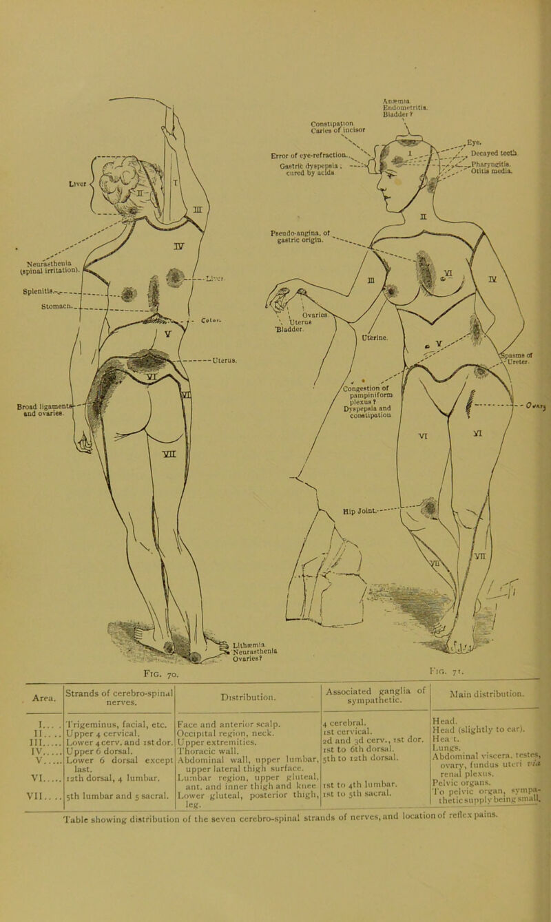 AD.Tmia Endoin»*trUi9. Bladder t ^^Eyc* Decayed teeth -^y^^-^PharyncUla. OtUia media. Neuni^lheula (BplDUl irritation) Bpienitls.-.--... Stomociu. Broad ligamenta * and ovariea Area. Strands of cerebro-spinal nerves. I.... Prigeminus, facial, etc. 11.... Upper 4 cervical. Ill Lower 4 cerv. and ist dor. IV Upper 6 dorsal. V Lower 6 dorsal except last. VI I2th dorsal, 4 lumbar. VII.. .. 5th lumbar and 5 sacral. Table showing distribulio Distribution. Associated jranglia of sympathetic. 4 cerebral, ist cervical. 2d and 3d cerv., ist dor. 1st to 6lh dorsal. 5th to 12th dorsal. Face and anterior scalp. Occipital region, neck. Upper e.xtremitics. Tnoracic wall. .Abdominal wall, upper lumbar, upper lateral thigh surface. Lumbar region, upper gluteal. ant. and inner thigh and knee Lower gluteal, posterior thigh, _Icg. 1 of the seven ccrebro-spinal strands of nerves, and location of rcllc.x pains ist to 4th lumbar. 1st to 5th sacral. Main distribution. Head. Head (slightly to ear). Ilea t. I.ungs. Abdominal viscera, testes, ovary, fundus uteri r /.* renal ple.xus. Pelvic organs. 'To pelvic organ, sympa- thetic supply beingsn^U {1