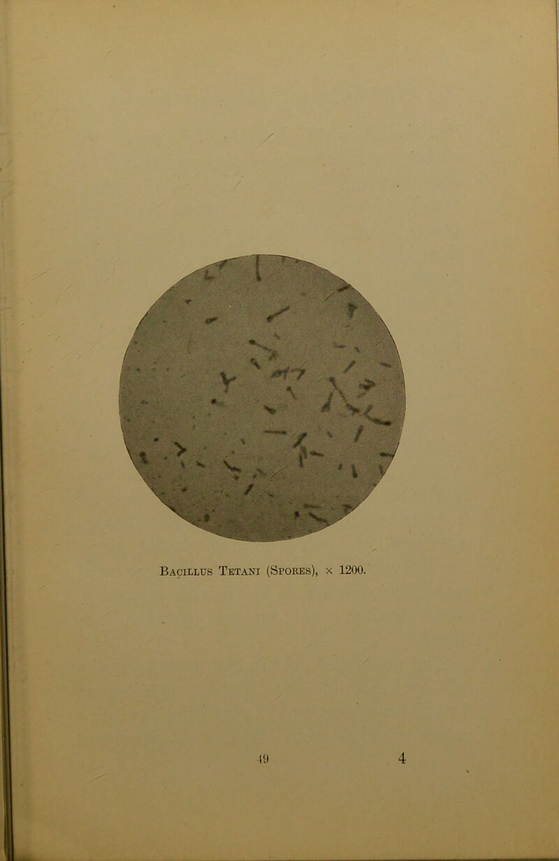 Bacillus Tetani (Spores), x 1200.