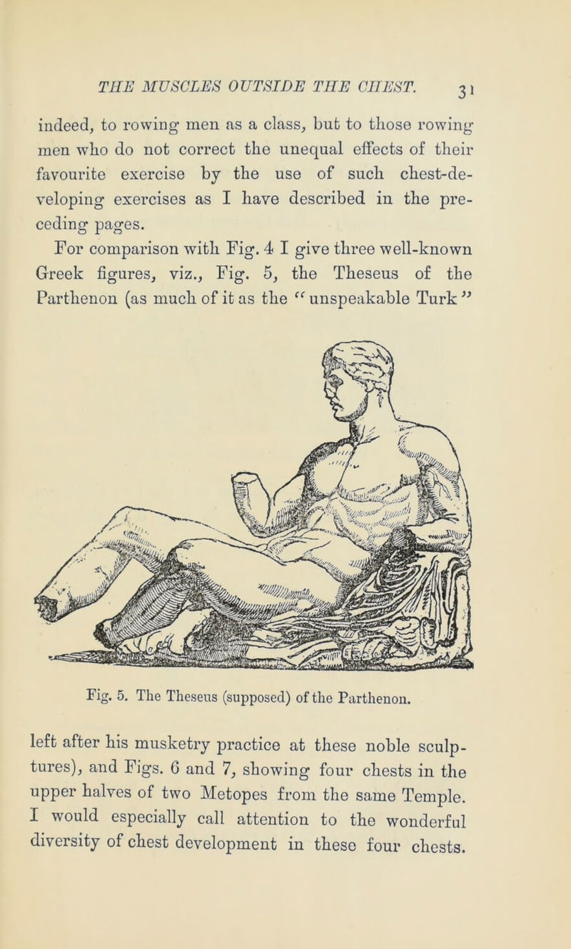 3» indeed, to rowing men as a class, but to those rowing men who do not correct the unequal effects of their favourite exercise by the use of such chest-de- veloping exercises as I have described in the pre- ceding pages. For comparison with Fig. 4 I give three well-known Greek figures, viz.. Fig. 5, the Theseus of the Parthenon (as much of it as the unspeakable Turk ” Fig. 5. The Theseus (supposed) of the Parthenon. left after his musketry practice at these noble sculp- tures), and Figs. 6 and 7, showing four chests in the upper halves of two Metopes from the same Temple. I would especially call attention to the wonderfid diversity of chest development in these four chests.