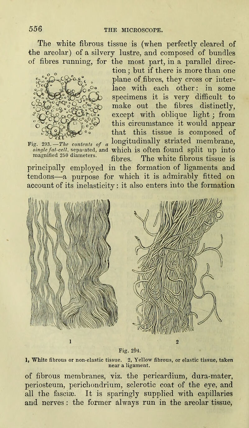 The white fibrous tissue is (when perfectly cleared of the areolar) of a silvery lustre, and composed of bundles of fibres running, for the most part, in a parallel direc- „ tion ; but if there is more than one plane of fibres, they cross or inter- lace with each other: in some specimens it is very difficult to make out the fibres distinctly, except with oblique light; from this circumstance it would appear that this tissue is composed of longitudinally striated membrane, single fat-cell, separated, and which is often found Split Up into magnified 250 diameters. p, mu i*. ci fibres. 1 he white fibrous tissue is principally employed in the formation of ligaments and tendons—a purpose for which it is admirably fitted on account of its inelasticity: it also enters into the formation Fig. 293. —The contenfs of a 1 2 Fig. 2§4. 1, White fibrous or non-elastic tissue. 2, Yellow fibrous, or elastic tissue, taken near a ligament. of fibrous membranes, viz. the pericardium, dura-mater, periosteum, perichondrium, sclerotic coat of the eye, and all the fasciae. It is sparingly supplied with capillaries and nerves : the former always run in the areolar tissue,