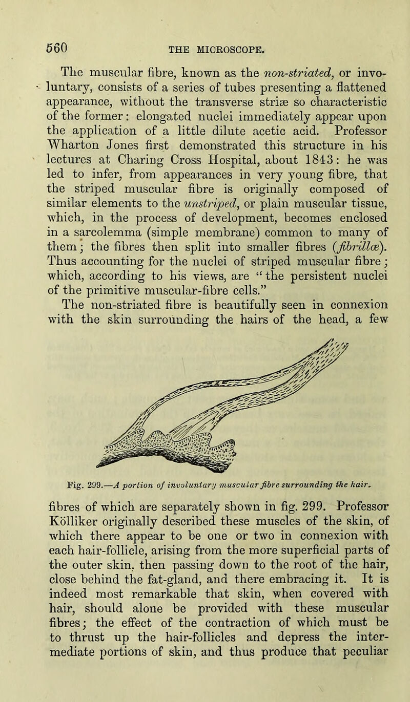 Tlie muscular fibre, known as the non-striated, or invo- luntary, consists of a series of tubes presenting a flattened appeai’ance, without the transverse striae so characteristic of the former: elongated nuclei immediately appear upon the application of a little dilute acetic acid. Professor Wharton Jones first demonstrated this structure in his lectures at Charing Cross Hospital, about 1843: he was led to infer, from appearances in very young fibre, that the striped muscular fibre is originally composed of similar elements to the unstriped, or plain muscular tissue, which, in the process of development, becomes enclosed in a sarcolemma (simple membrane) common to many of them; the fibres then split into smaller fibres (fibrillce). Thus accounting for the nuclei of striped muscular fibre; which, according to his views, are “ the persistent nuclei of the primitive muscular-fibre cells.” The non-striated fibre is beautifully seen in connexion with the skin surrounding the hairs of the head, a few Fig. 299.—A portion of involuntary muscular fibre surrounding the hair- fibres of which are separately shown in fig. 299. Professor Kolliker originally described these muscles of the skin, of which there appear to be one or two in connexion with each hair-follicle, arising from the more superficial parts of the outer skin, then passing down to the root of the hair, close behind the fat-gland, and there embracing it. It is indeed most remarkable that skin, when covered with hair, should alone be provided with these muscular fibres; the effect of the contraction of which must be to thrust up the hair-follicles and depress the inter- mediate portions of skin, and thus produce that peculiar