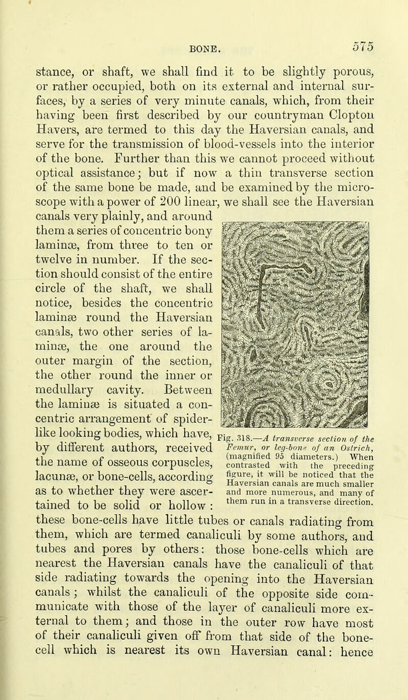 stance, or shaft, we shall And it to be slightly porous, or rather occupied, both on its external and internal sur- faces, by a series of very minute canals, which, from their having been first described by our countryman Clopton Havers, are termed to this day the Haversian canals, and serve for the transmission of blood-vessels into the interior of the bone. Further than this we cannot proceed without optical assistance; but if now a thin transverse section of the same bone be made, and be examined by the micro- scope with a power of 200 linear, we shall see the Haversian canals very plainly, and around them a series of concentric bony laminoe, from three to ten or twelve in number. If the sec- tion should consist of the entire circle of the shaft, we shall notice, besides the concentric laminse round the Haversian canals, two other series of la- mince, the one around the outer margin of the section, the other round the inner or medullary cavity. Between the laminae is situated a con- centric arrangement of spider- like looking bodies, which have, Fif? ^8 —a~tn by different authors, received the name of osseous corpuscles, lacunae, or bone-cells, according as to whether they were ascer- tained to be solid or hollow : these bone-cells have little tubes or canals radiating from them, which are termed canaliculi by some authors, and tubes and pores by others: those bone-cells which are nearest the Haversian canals have the canaliculi of that side radiating towards the opening into the Haversian canals; whilst the canaliculi of the opposite side com- municate with those of the layer of canaliculi more ex- ternal to them; and those in the outer row have most of their canaliculi given off from that side of the bone- cell which is nearest its own Haversian canal: hence ansverse section of the Femur, or leg-bone of an Ostrich, (magnified 95 diameters.) When contrasted with the preceding figure, it, will he noticed that the Haversian canals are much smaller and more numerous, and many of them run in a transverse direction.