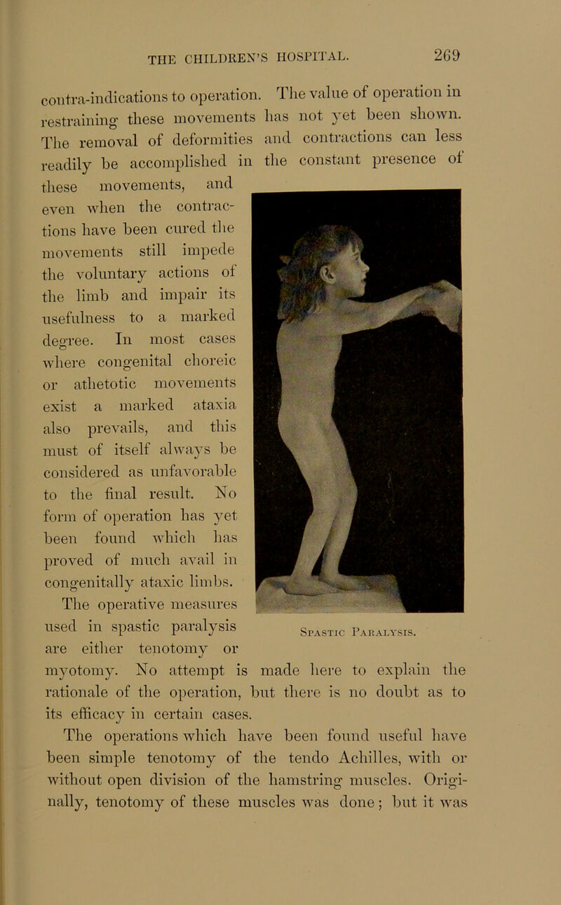 contra-indications to operation. The value of operation in restraining’ these movements has not ^ et been shown. rpp0 removal of deformities and contiactions can less readily be accomplished in the constant presence of these movements, and even when the contrac- tions have been cured the movements still impede the voluntary actions of the limb and impair its usefulness to a marked decree. In most cases © where congenital choreic or athetotic movements exist a marked ataxia also prevails, and this must of itself always be considered as unfavorable to the final result. No form of operation has yet been found which has proved of much avail in congenitally ataxic limbs. The operative measures used in spastic paralysis are either tenotomy or myotomy. No attempt is made here to explain the rationale of the operation, but there is no doubt as to its efficacy in certain cases. The operations which have been found useful have been simple tenotomy of the tendo Achilles, with or without open division of the hamstring muscles. Origi- nally, tenotomy of these muscles was done; but it was SrASTic Paralysis.