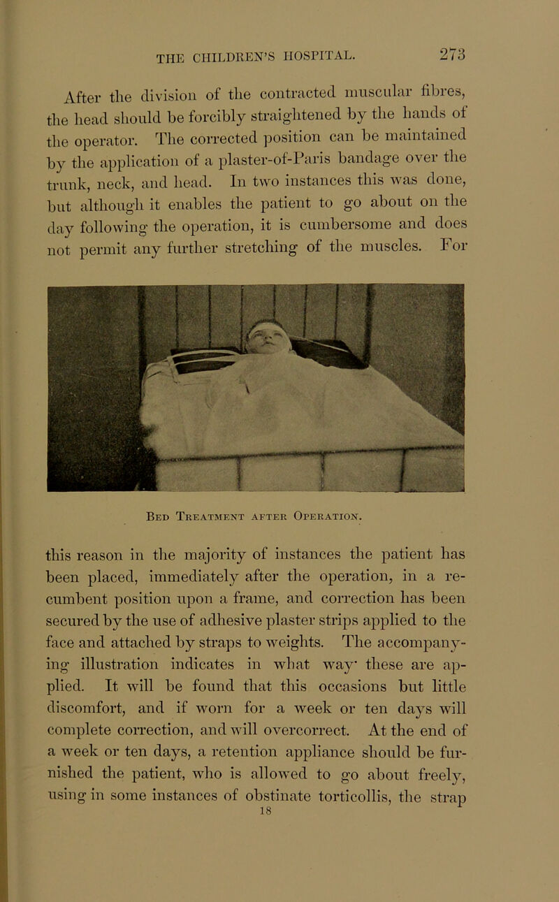 After the division of the contracted muscular fibres, the head should be forcibly straightened by the hands of the operator. The corrected position can be maintained by the application of a plaster-of-Paris bandage over the trunk, neck, and head. In two instances this was done, but although it enables the patient to go about on the day following the operation, it is cumbersome and does not permit any further stretching of the muscles. I or Bed Treatment after Operation. this reason in the majority of instances the patient has been placed, immediately after the operation, in a re- cumbent position upon a frame, and correction has been secured by the use of adhesive plaster strips applied to the face and attached by straps to weights. The accompany- ing illustration indicates in what way these are ap- plied. It will be found that this occasions but little discomfort, and if worn for a week or ten days will complete correction, and will overcorrect. At the end of a week or ten days, a retention appliance should be fur- nished the patient, who is allowed to go about freely, using in some instances of obstinate torticollis, the strap