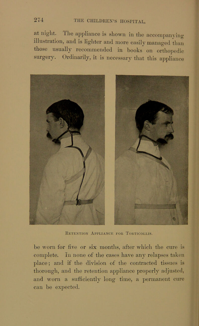 <it niglit. 11ig appliance is shown in the accompanying illustration, and is lighter and more easily managed than those usually recommended in books on orthopedic surgery. Ordinarily, it is necessary that this appliance Retention Appliance for Torticollis. be worn for five or six months, after which the cure is complete. In none of the cases have any relapses taken place; and if the division of the contracted tissues is thorough, and the retention appliance properly adjusted, and worn a sufficiently long time, a permanent cure can be expected.