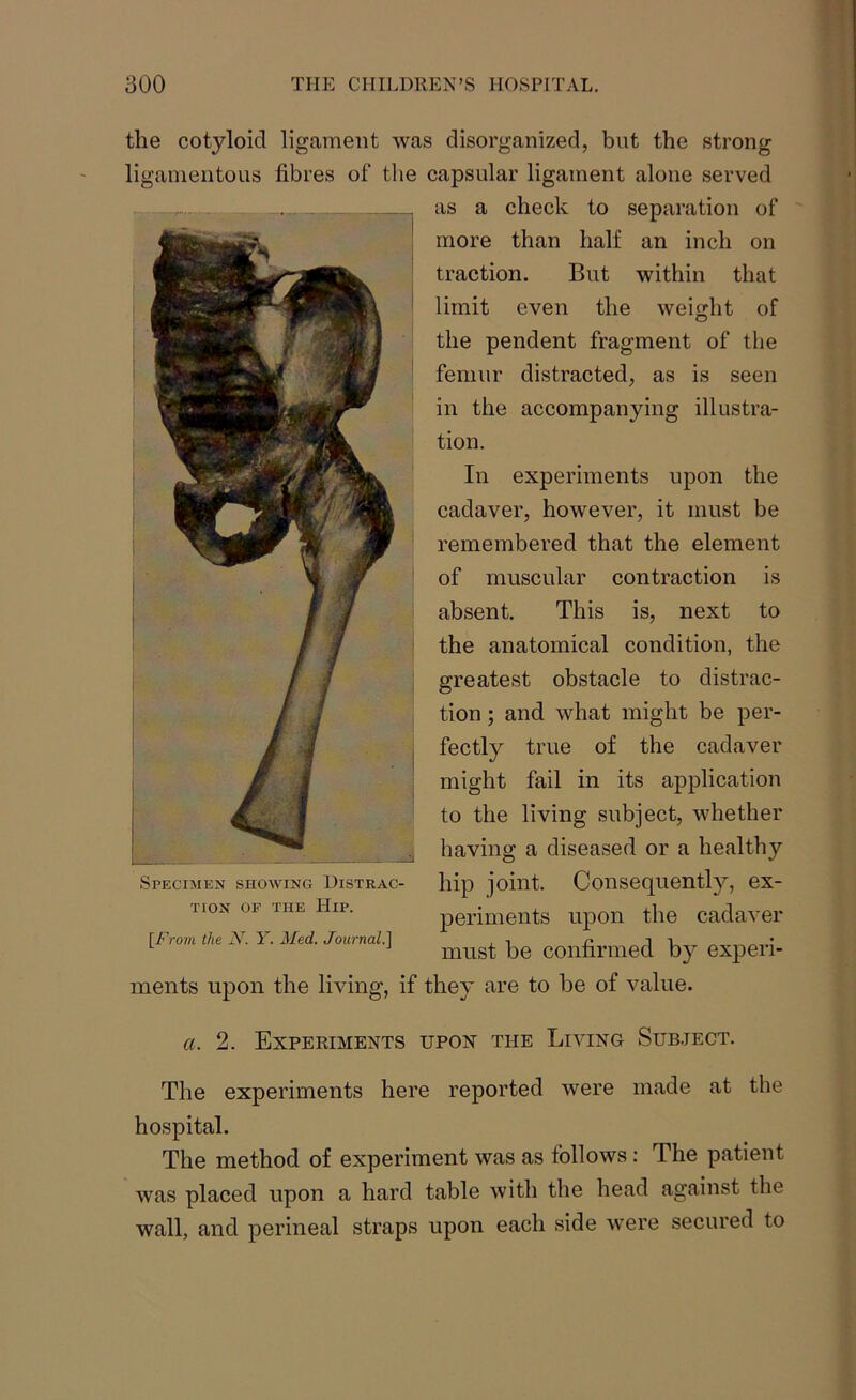 the cotyloid ligament was disorganized, but the strong ligamentous fibres of the capsular ligament alone served as a check to separation of more than half an inch on traction. But within that limit even the weight of the pendent fragment of the femur distracted, as is seen in the accompanying illustra- tion. In experiments upon the cadaver, however, it must be remembered that the element of muscular contraction is absent. This is, next to the anatomical condition, the greatest obstacle to distrac- tion ; and what might be per- fectly true of the cadaver might fail in its application to the living subject, whether having a diseased or a healthy hip joint. Consequently, ex- periments upon the cadaver fFrom the N. Y. Med. Journal.1 . -i must be confirmed by experi- ments upon the living, if they are to be of value. Specimen showing Distrac- tion of the Hip. a. 2. Experiments upon the Living Subject. The experiments here reported were made at the hospital. The method of experiment was as follows: The patient was placed upon a hard table with the head against the wall, and perineal straps upon each side were secured to
