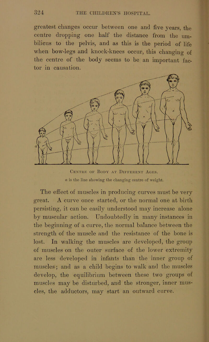 greatest changes occur between one and five years, the centre dropping one half the distance from the um- bilicus to the pelvis, and as this is the period of life when bow-legs and knock-knees occur, this changing of the centre of the body seems to be an important fac- tor in causation. Centre of Body at Different Ages. a is the line showing the changing centre of weight. The effect of muscles in producing curves must be very great. A curve once started, or the normal one at birth persisting, it can be easily understood may increase alone by muscular action. Undoubtedly in many instances in the beginning of a curve, the normal balance between the strength of the muscle and the resistance of the bone is lost. In walking the muscles are developed, the group of muscles on the outer surface of the lower extremity are less developed in infants than the inner group of muscles; and as a child begins to walk and the muscles develop, the equilibrium between these two groups of muscles may be disturbed, and the stronger, inner mus- cles, the adductors, may start an outward curve.