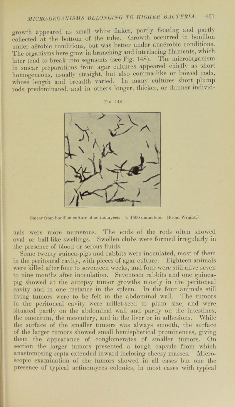 growth appeared as small white flakes, partly floating and paitly collected at the bottom of the tube. Growth occurred in bouillon under aerobic conditions, but was better under anaerobic conditions. The organisms here grow in branching and interlacing filaments, which later tend to break into segments (see Fig. 148). The microorganism in smear preparations from agar cultures appeared chiefly as short homogeneous, usually straight, but also comma-like or bowed rods, whose length and breadth varied. In many cultures short plump rods predominated, and in others longer, thicker, or thinner individ- Fig. 148 Smear from bouillon culture of actinomyces. X 1500 diameters. (From Wright.) uals were more numerous. The ends of the rods often showed oval or ball-like swellings. Swollen clubs were formed irregularly in the presence of blood or serous fluids. Some twenty guinea-pigs and rabbits were inoculated, most of them in the peritoneal cavity, with pieces of agar culture. Eighteen animals were killed after four to seventeen weeks, and four were still alive seven to nine months after inoculation. Seventeen rabbits and one guinea- pig showed at the autopsy tumor growths mostly in the peritoneal cavity and in one instance in the spleen. In the four animals still living tumors were to be felt in the abdominal wall. The tumors in the peritoneal cavity were millet-seed to plum size, and were situated partly on the abdominal wall and partly on the intestines, the omentum, the mesentery, and in the liver or in adhesions. While the surface of the smaller tumors was always smooth, the surface of the larger tumors showed small hemispherical prominences, giving them the appearance of conglomerates of smaller tumors. On section the larger tumors presented a tough capsule from which anastomosing septa extended inward inclosing cheesy masses. Micro- scopic examination of the tumors showed in all cases but one the presence of typical actinomyces colonies, in most cases with typical
