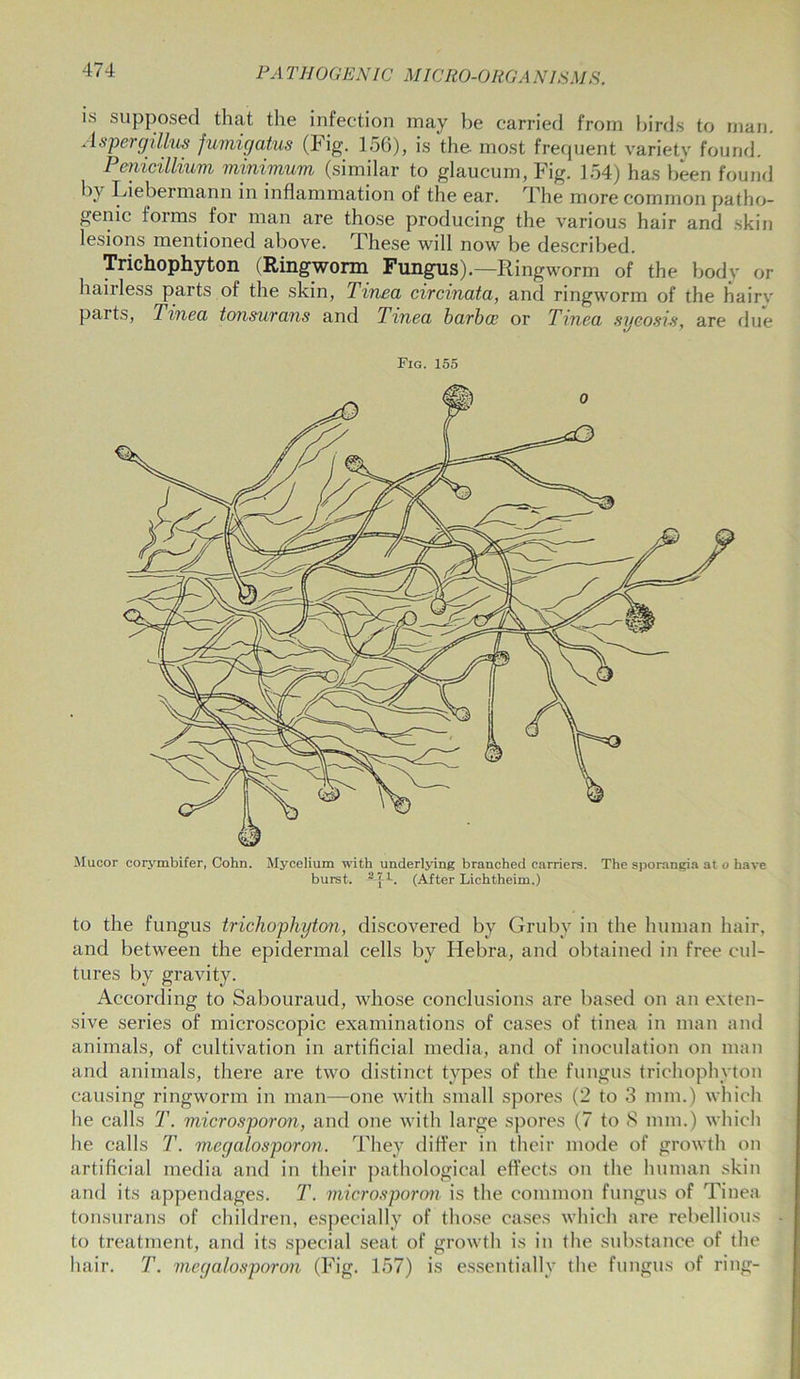 is supposed that the infection may be carried from birds to man. Aspergillus fumigatus (Fig. 156), is the most frequent variety found. Penicillium minimum (similar to glaucum, Fig. 154) has been found by Liebermann in inflammation of the ear. The more common patho- genic forms for man are those producing the various hair and skin lesions mentioned above. These will now be described. Trichophyton (Ringworm Fungus).—Ringworm of the body or hairless parts of the skin, Tinea circinata, and ringworm of the hairv parts, Tinea tonsurans and Tinea barboe or Tinea sycosis, are due Fig. 155 Mucor corymbifer, Cohn. Mycelium with underlying branched carriers. The sporangia at o have burst. AI.L. (After Lichtheim.) to the fungus trichophyton, discovered by Grubv in the human hair, and between the epidermal cells by Hebra, and obtained in free cul- tures by gravity. According to Sabouraud, whose conclusions are based on an exten- sive series of microscopic examinations of cases of tinea in man and animals, of cultivation in artificial media, and of inoculation on man and animals, there are two distinct types of the fungus trichophyton causing ringworm in man—one with small spores (2 to 3 mm.) which he calls T. microsporon, and one with large spores (7 to 8 mm.) which he calls T. megalosporon. They differ in their mode of growth on artificial media and in their pathological effects on the human skin and its appendages. T. microsporon is the common fungus of Tinea tonsurans of children, especially of those cases which are rebellious to treatment, and its special seat of growth is in the substance of the hair. T. megalosporon (Fig. 157) is essentially the fungus of ring-