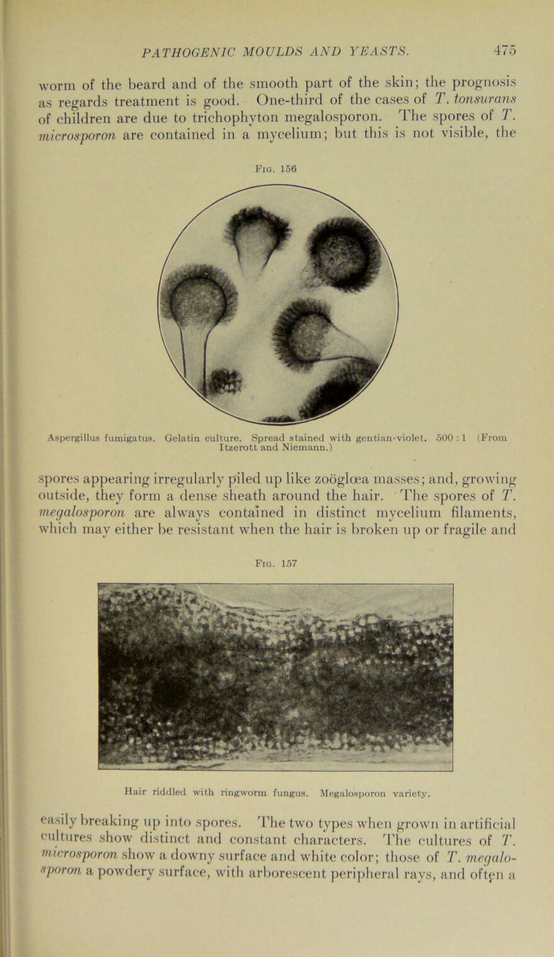worm of the beard and of the smooth part of the skin; the prognosis as regards treatment is good. One-third of the cases of 7’. tonsurans of children are due to trichophyton megalosporon. The spores of T. microsporon are contained in a mycelium; but this is not visible, the Fig. 156 Aspergillus fumigatus. Gelatin culture. Spread stained with gentian-violet. 500 : 1 (From Itzerott and Niemann.) spores appearing irregularly piled up like zooglcea masses; and, growing outside, they form a dense sheath around the hair. The spores of T. megalosporon are always contained in distinct mycelium filaments, which may either be resistant when the hair is broken up or fragile and Fig. 157 Hair riddled with ringworm fungus. Megalosporon variety. easily breaking up into spores. The two types when grown in artificial cultures show distinct and constant characters. The cultures of 7’. microsporon show a downy surface and white color; those of T. megalo- sporon a powdery surface, with arborescent peripheral rays, and oftpn a