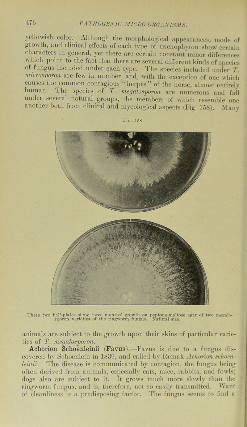 yellowish color. Although the morphological appearances, mode of growth, and clinical eflects of each type of trichophyton show' certain characters in general, yet there are certain constant minor differences which point to the fact that there are several different kinds of species of fungus included under each type. The species included under T. microsporon are few in number, and, with the exception of one which causes the common contagious herpes” of the horse, almost entirely human. The species of T. mecjalosporon are numerous and fail undei several natural groups, the members of which resemble one another both from clinical and mycological aspects (Fig. 158). Many Fig. 158 These two half-plates show three months’ growth on peptone-maltose agar of two megalo- sporon varieties of the ringworm fungus. Natural size. animals are subject to the growth upon their skins of particular varie- ties of T. mecjalosporon. Achorion Schoenleinii (Favus).—Favus is due to a fungus dis- covered by Schoenlein in 1839, and called by Remak Achorion schom- leinii. The disease is communicated by contagion, the fungus being often derived from animals, especially cats, mice, rabbits, and fowls; dogs also are subject to it. It grows much more slowdy than the ringworm fungus, and is, therefore, not so easily transmitted. Want of cleanliness is a predisposing factor. The fungus seems to find a