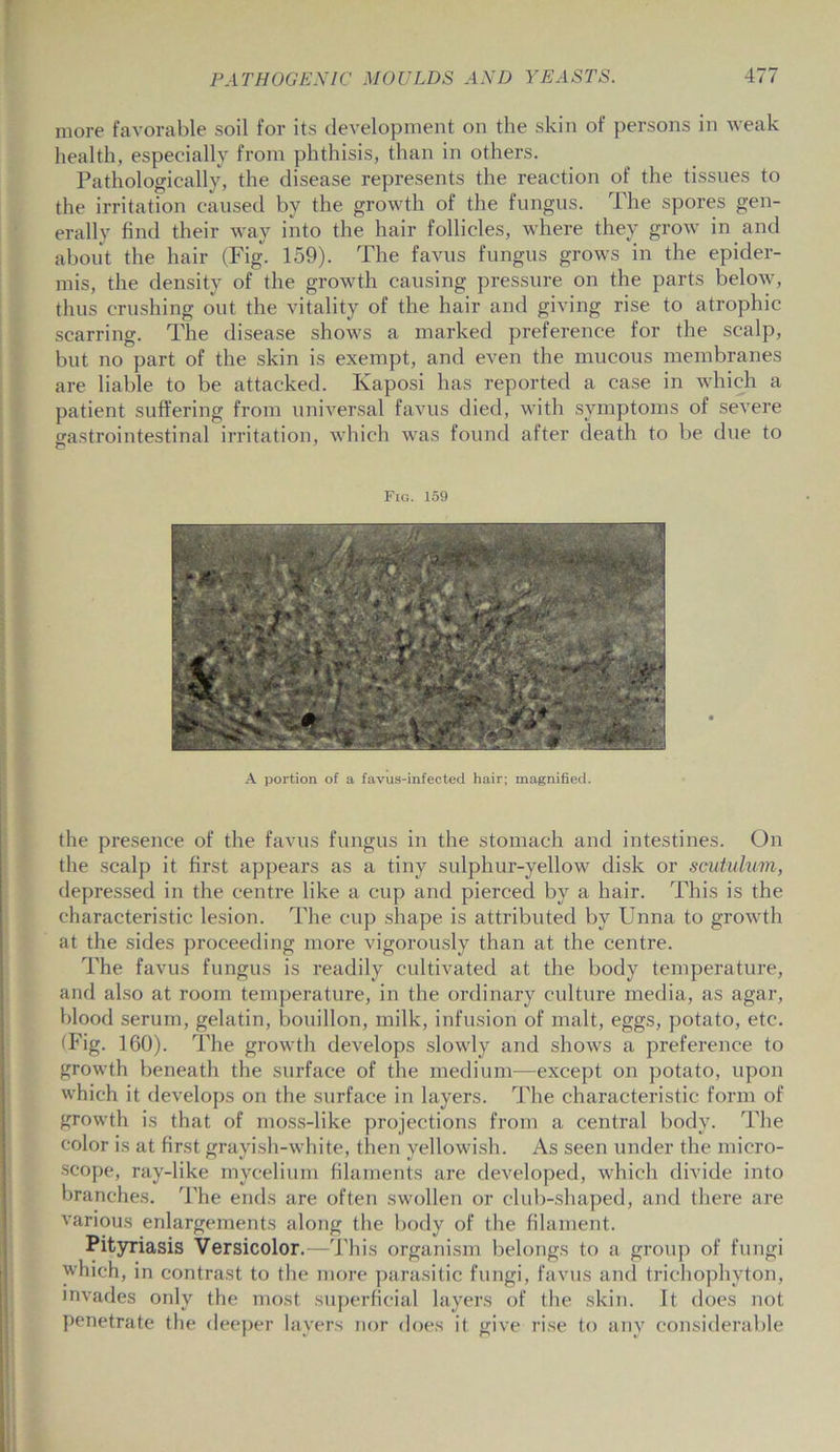 more favorable soil for its development on the skin of persons in weak health, especially from phthisis, than in others. Pathologically, the disease represents the reaction of the tissues to the irritation caused by the growth of the fungus. The spores gen- erally find their way into the hair follicles, where they grow in and about the hair (Fig. 159). The favus fungus grows in the epider- mis, the density of the growth causing pressure on the parts below, thus crushing out the vitality of the hair and giving rise to atrophic scarring. The disease shows a marked preference for the scalp, but no part of the skin is exempt, and even the mucous membranes are liable to be attacked. Kaposi has reported a case in which a patient suffering from universal favus died, with symptoms of severe gastrointestinal irritation, which was found after death to be due to Fig. 159 A portion of a favus-infected hair; magnified. the presence of the favus fungus in the stomach and intestines. On the scalp it first appears as a tiny sulphur-yellow disk or scutulum, depressed in the centre like a cup and pierced by a hair. This is the characteristic lesion. The cup shape is attributed by Unna to growth at the sides proceeding more vigorously than at the centre. The favus fungus is readily cultivated at the body temperature, and also at room temperature, in the ordinary culture media, as agar, blood serum, gelatin, bouillon, milk, infusion of malt, eggs, potato, etc. (Fig. 160). The growth develops slowly and shows a preference to growth beneath the surface of the medium—except on potato, upon which it develops on the surface in layers. The characteristic form of growth is that of moss-like projections from a central body. The color is at first grayish-white, then yellowish. As seen under the micro- scope, ray-like mycelium filaments are developed, which divide into branches. The ends are often swollen or club-shaped, and there are various enlargements along the body of the filament. Pityriasis Versicolor.—This organism belongs to a group of fungi which, in contrast to the more parasitic fungi, favus and trichophyton, invades only the most superficial layers of the skin. It does not penetrate the deeper layers nor does it give rise to any considerable
