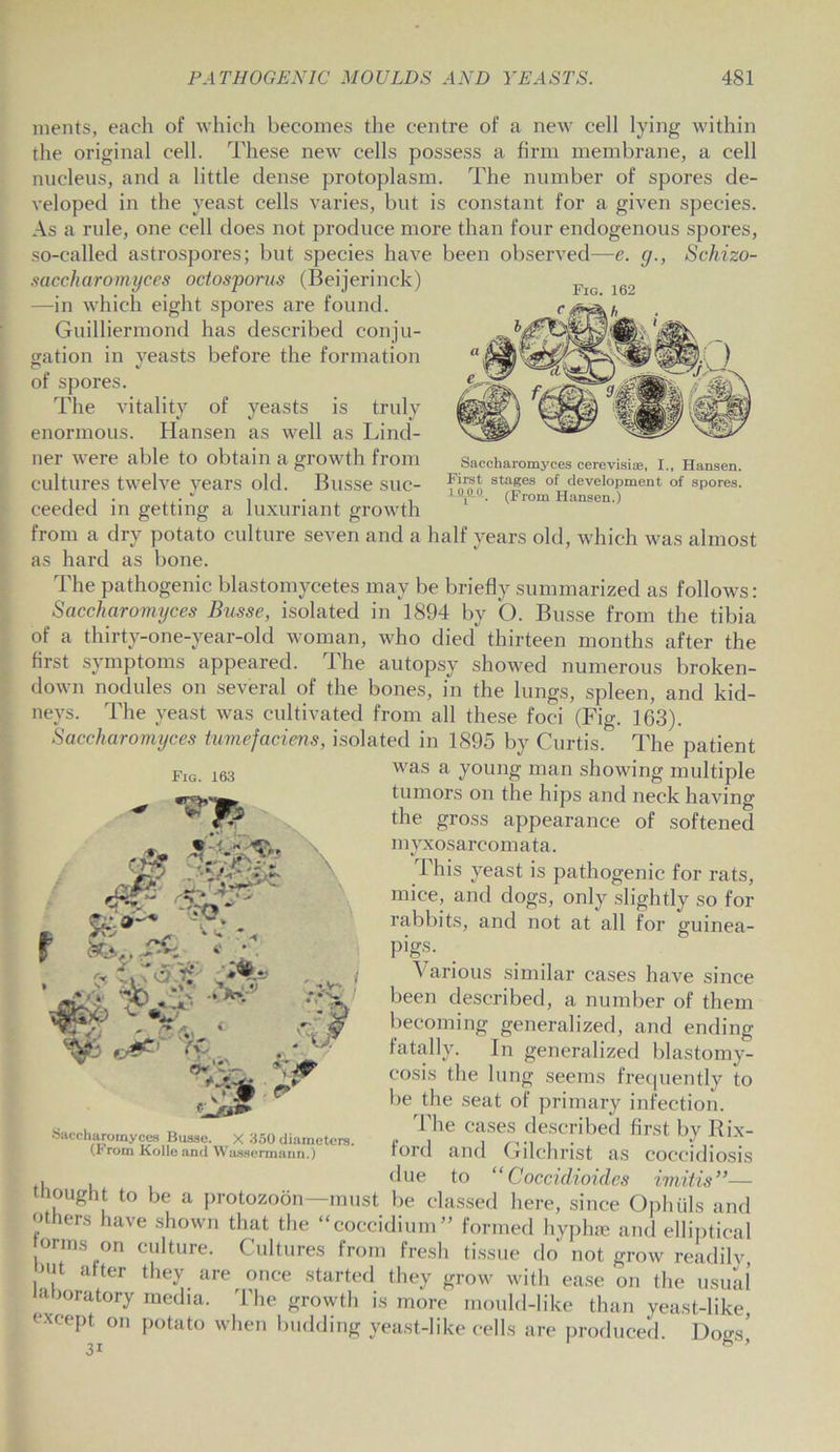 Fig. 162 Saceharomyces cerevisise, I., Hansen. First stages of development of spores. (From Hansen.) 1 OJIO inents, each of which becomes the centre of a new cell lying within the original cell. These newT cells possess a firm membrane, a cell nucleus, and a little dense protoplasm. The number of spores de- veloped in the yeast cells varies, but is constant for a given species. As a rule, one cell does not produce more than four endogenous spores, so-called astrospores; but species have been observed—e. g., Schizo- saccharomyces octosporus (Beijerinck) —in which eight spores are found. Guilliermond has described conju- gation in yeasts before the formation of spores. The vitality of yeasts is truly enormous. Hansen as well as Lind- ner were able to obtain a growth from cultures twelve years old. Busse suc- ceeded in getting a luxuriant growth from a dry potato culture seven and a half years old, which was almost as hard as bone. The pathogenic blastomycetes may be briefly summarized as follows: Saccliciromyces Busse, isolated in 1894 by O. Busse from the tibia of a thirty-one-year-old woman, who died thirteen months after the first symptoms appeared. The autopsy showed numerous broken- down nodules on several of the bones, in the lungs, spleen, and kid- neys. The yeast was cultivated from all these foci (Fig. 163). Saceharomyces tumefaciens, isolated in 1895 by Curtis. The patient was a young man showing multiple tumors on the hips and neck having the gross appearance of softened myxosarcomata. This yeast is pathogenic for rats, mice, and dogs, only slightly so for rabbits, and not at all for guinea- pigs. Various similar cases have since been described, a number of them becoming generalized, and ending fatally. In generalized blastomy- cosis the lung seems frequently to be the seat of primary infection. The cases described first by Rix- ford and Gilchrist as coccidiosis , , due to “ Cocci dioides imitis”— tnought to be a protozoon—must be classed here, since Ophuls and ? er's Iave shown that the “coecidium” formed hyphse and elliptical forms on culture. Cultures from fresh tissue do not grow readilv Hit alter they are once started they grow with ease on the usual laboratory media. The growth is more mould-like than yeast-like except on potato when budding yeast-like cells are produced. Dogs’ Fig. 163 ■sr r ■£p : ^ -V-) ‘V * w 4' If. -vr- ■:'o Saceharomyces Busse. X 350 diameters. (1* rom Kolle and Wawsermann.)