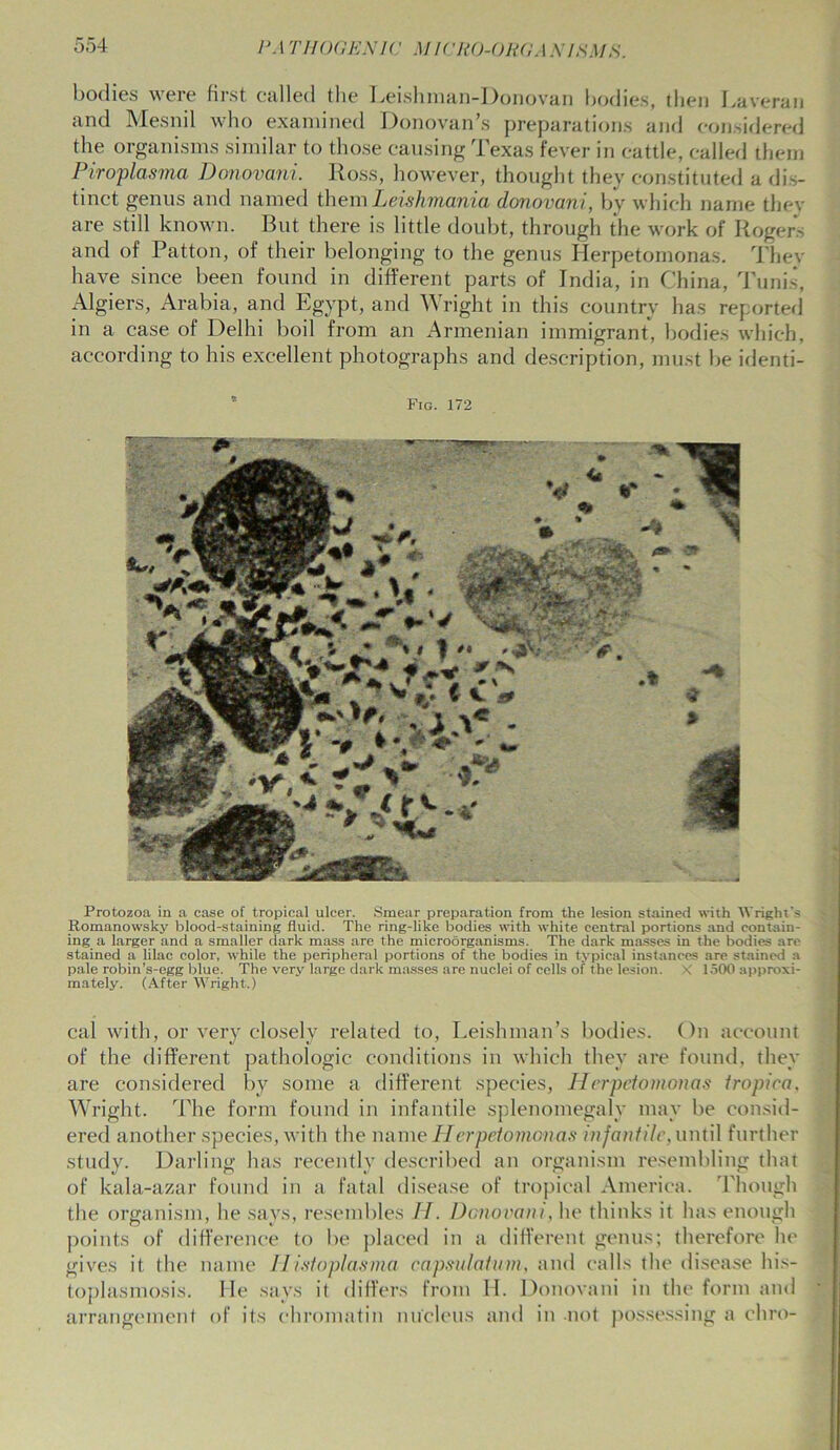 bodies were first called the Leishman-Donovan bodies, then Laveran and Mesnil who examined Donovan’s preparations and considered the organisms similar to those causing Texas fever in cattle, called them Piroplasma Donovani. Ross, however, thought they constituted a dis- tinct genus and named them Leislimania donovani, by which name they are still known. But there is little doubt, through the work of Rogers and of Patton, of their belonging to the genus Herpetomonas. They have since been found in different parts of India, in China, Tunis, Algiers, Arabia, and Egypt, and Wright in this country has reported in a case of Delhi boil from an Armenian immigrant, bodies which, according to his excellent photographs and description, must be identi- Fig. 172 Protozoa in a case of tropical ulcer. Smear preparation from the lesion stained with Wright's Romanowsky blood-staining fluid. The ring-like bodies with white central portions and contain- ing a larger and a smaller dark mass are the microorganisms. The dark masses in the bodies are stained a lilac color, while the peripheral portions of the bodies in typical instances are stained a pale robin’s-egg blue. The very large dark masses are nuclei of cells of the lesion. X 1500 approxi- mately. (After Wright.) cal with, or very closely related to, Leishman’s bodies. On account of the different pathologic conditions in which they are found, they are considered by some a different species, Herpetomonas tropica, Wright. The form found in infantile splenomegaly may be consid- ered another species, with the name Herpetomonas infantile, until further study. Darling has recently described an organism resembling that of kala-azar found in a fatal disease of tropical America. Though the organism, he says, resembles H. Donovani, he thinks it has enough points of difference to be placed in a different genus; therefore he gives it the name IIistoplasma capsulation, and calls the disease his- toplasmosis. He says it differs from H. Donovani in the form and arrangement of its chromatin nucleus and in not possessing a chro-