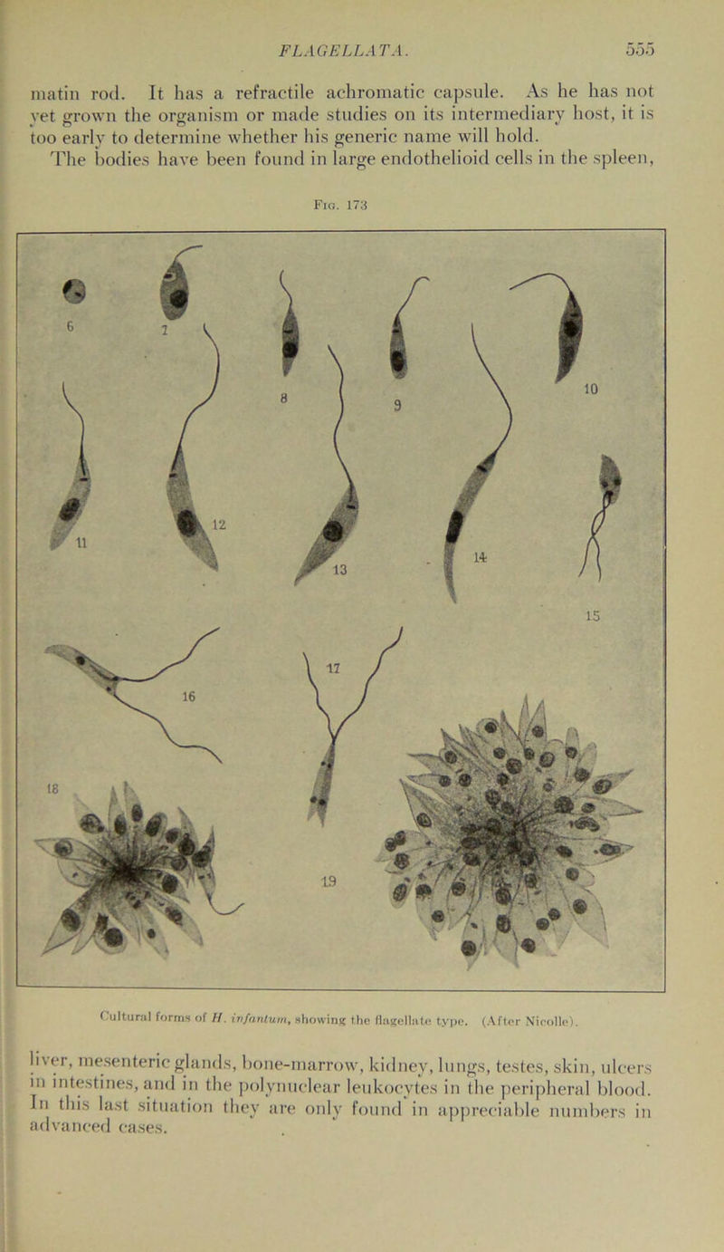 matin rod. It has a refractile achromatic capsule. As he has not vet grown the organism or made studies on its intermediary host, it is V ( ' *—7 ^ v too early to determine whether his generic name will hold. The bodies have been found in large endothelioid cells in the spleen, Fig. 173 Cultural forms of H. infantum, showing the flagellate type. (After Nicolle). liver, mesenteric glands, bone-marrow, kidney, lungs, testes, skin, ulcers in intestines, and in the polynuclear leukocytes in the peripheral blood. In this last situation they are only found in appreciable numbers in advanced cases.