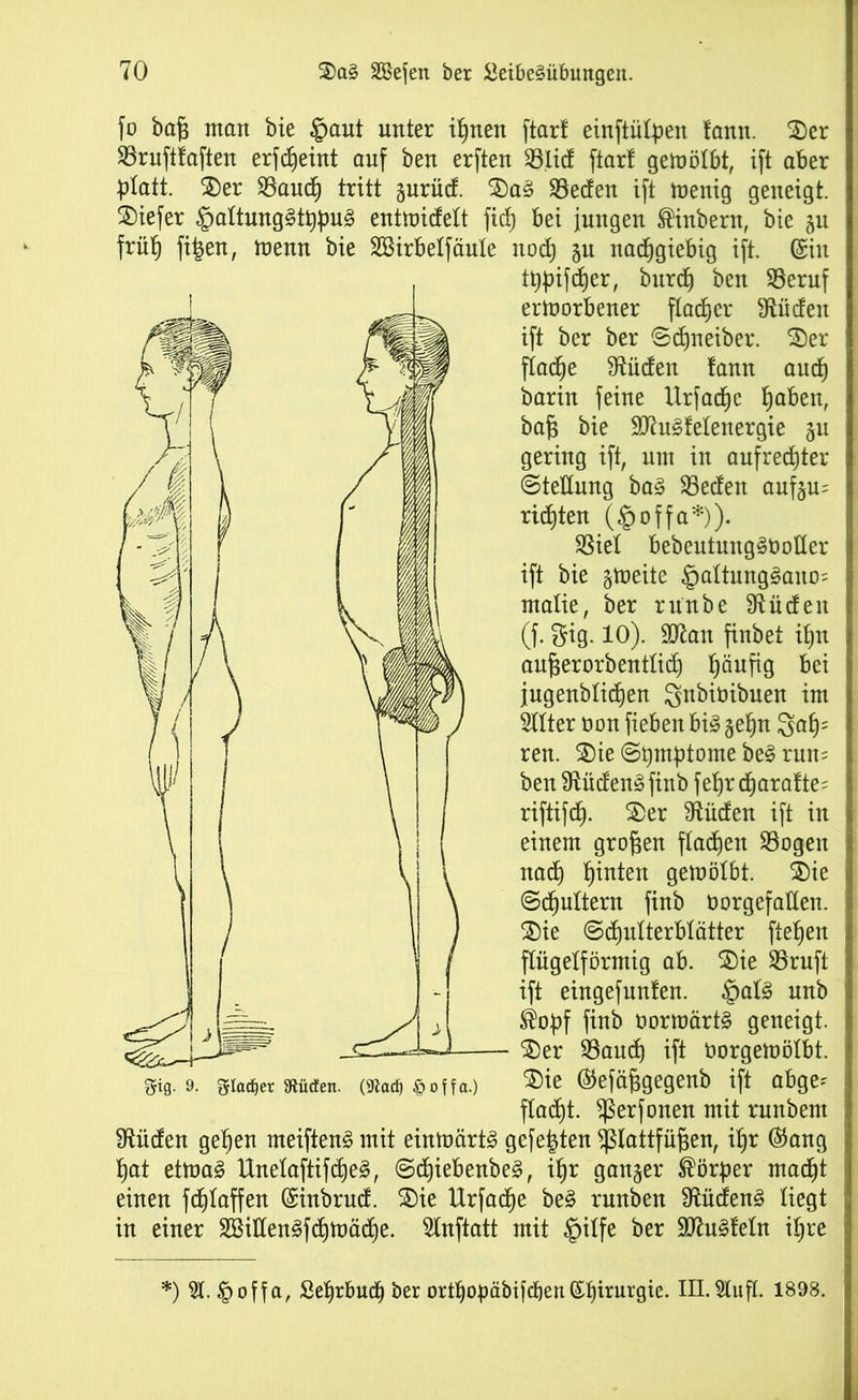 fo bafe man bie §aut unter ihnen ftarf einftülpen lann. 3)er Sruftlaften erfcheint auf ben erften Slid ftarl gemölbt, ift aber platt. $)er Saud) tritt §urüd. £)aS Reifen ift menig geneigt, tiefer ^altungStppuS entmidelt fid) bei jungen ®inbent, bie §u früh fi|en, menn bie SSirbelfäule nod) §u nachgiebig ift. ©in tppifcher, burdj ben Seruf ertnorbener flacher sJttideit ift ber ber Sdjneiber. S)er ftad^e S^üden fann and) barin feine Urfadjc bjaben, bafj bie SKuSfelenergie §u gering ift, um in aufrechter Stellung baS Seden aufeu= richten (§offa*)). SSiel bebeutungSöotter ift bie §meite §altungSaito; malie, ber runbe Etüden (f. gig. 10). SOian finbet ihn aufjerorb entlief) häufig bei jugenblichen gnbimbuen im 5llter non fieben bis §ehn 3teh= ren. £)ie (Spmptome beS run= ben Südens finb fehr charafte^ riftifd). £)er Etüden ift in einem großen flachen Sogen nad) h^ten gemötbt. 2)ie Schultern finb oorgefalleu. 2)ie Schulterblätter flehen flügelförmig ab. $)ie Sruft ift eingefunfen. §alS unb ®opf finb oormärtS geneigt. - $)er Saud) ift üorgemölbt. $)ie ©efäfjgegenb ift abge- flacht. ^erfonen mit runbent üiüden gehen meiftenS mit einmärtS gefegten ^lattfüjkn, il)r ©ang hat etmaS UnelaftifdieS, SdjiebenbeS, ihr ganzer Körper madht einen fdjlaffen ©inbrud. $)ie Urfache beS runben Südens liegt in einer SSidenSfchmäche. 5lnftatt mit §ilfe ber 9ttu§feln il)re $ig. 9. glaset «Rüden. (9tacf) offa.) *) 51. §offa, Sehrbuch ber orthopäbifd)ert©f)irur9ie- Hl.Slufl. 1898.