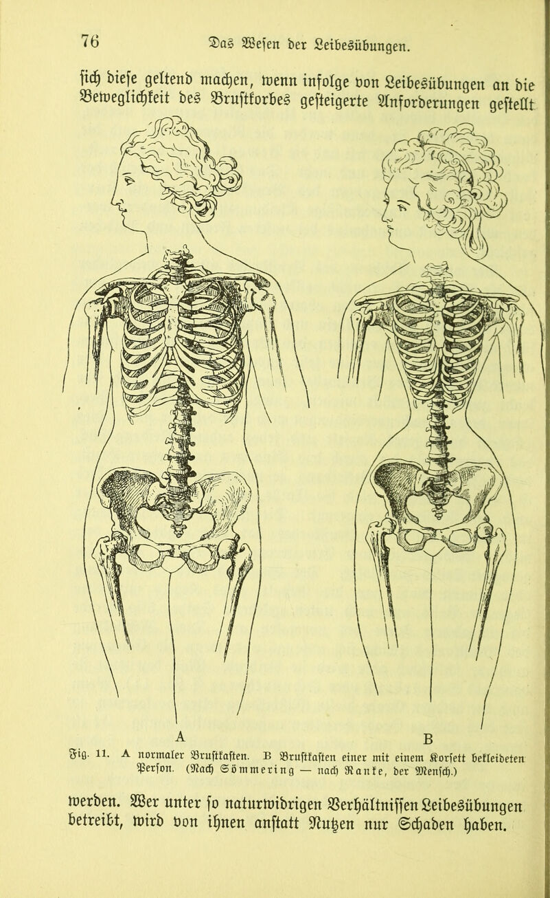 fidj biefe geltenb machen, wenn infolge Bon ßeibe&ibungen an bic SeWeglidjfeit be? SSruftforbe« gefteigerte Slnforberungen geftetft A B gig. ll. A normaler 33ruftfaften. B SBruftfaften einer mit einem ®orfett befleibeten ißerfon. (Sftacfj ©ömntering — nadj 3Rante, ber SDlenfd).) werben. SBer unter fo naturwibrigen ®er|ältniffenSeibe§übungen betreibt, wirb Bon itjnen anftatt 9tu|en nur ©cfiaben tjaben.