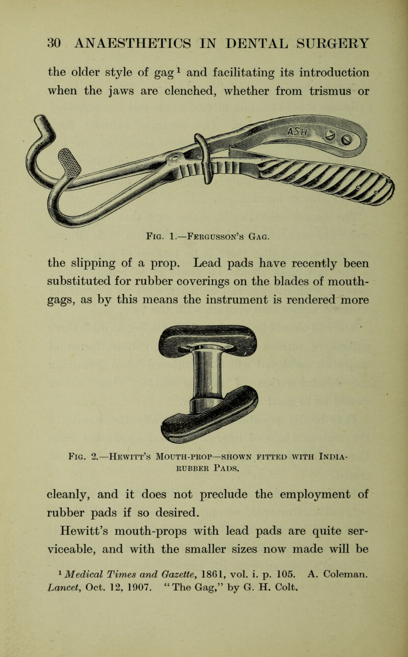the older style of gag1 and facilitating its introduction when the jaws are clenched, whether from trismus or Fig. 1.—Fergusson’s Gag. the slipping of a prop. Lead pads have recently been substituted for rubber coverings on the blades of mouth- gags, as by this means the instrument is rendered more Fig. 2.—Hewitt’s Mouth-prop—shown fitted with India- rubber Pads. cleanly, and it does not preclude the employment of rubber pads if so desired. Hewitt’s mouth-props with lead pads are quite ser- viceable, and with the smaller sizes now made will be 1 Medical Times and Gazette, 1861, vol. i. p. 105. A. Coleman. Lancet, Oct. 12, 1907. “The Gag,” by G. H. Colt.
