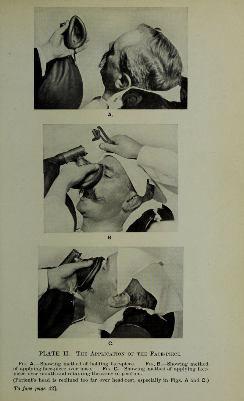 c. PLATE II.—The Application of the Face-piece. Fig. A.—Showing method of holding face-piece. Fig. B.—Showing method of applying face-piece over nose. Fig. C.—Showing method of applying face- piece over mouth and retaining the same in position. (Patient’s head is reclined too far over head-rest, especially in Figs. A and C.) To face 42].