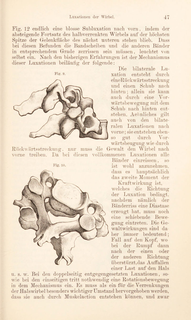 Fig. 12 endlich eine blosse Subluxation nach vorn, indem der absteigende Fortsatz des halb verrenkten Wirbels auf der höchsten Spitze der Gelenkfläche des nächst unteren stehen blieb. Dass bei diesen Befunden die Bandscheiben und die anderen Bänder in entsprechendem Grade zerrissen sein müssen, leuchtet von selbst ein. Nach den bisherigen Erfahrungen ist der Mechanismus dieser Luxationen beiläufig der folgende: Die bilaterale Lu- xation entsteht durch eineRii ck w ä r tsstreck ung und einen Schub nach hinten ; allein sie kann auch durch eine Vor- wärtsbewegung mit dem Schub nach hinten ent- stehen. Aelmliches gilt auch von den bilate- ralen Luxationen nach vorne; sie entstehen eben- so gut durch Vor- wärtsbeugung wie durch Rückwärtsstreckung, nur muss die Gewalt den Wirbel nach vorne treiben. Da bei diesen vollkommenen Luxationen alle Bänder einreissen, so Fi£-10- ist wohl anzunehmen. dass es hauptsächlich das zweite Moment der Kraft Wirkung ist, welches die Richtung der Luxation bedingt, nachdem nämlich der Bänderriss eine Diastase erzeugt hat, muss noch eine schiebende Bewe- gung eintreten. Die Ge- waltwirkungen sind da her immer bedeutend; Fall auf den Kopf, wo bei der Rumpf dann nach der einen oder der anderen Richtung überstürzt,das Auffallen einer Last auf den Hals u. s. w. Bei den doppelseitig entgegengesetzten Luxationen, so- wie bei den einseitigen tritt nothwendig eine Rotationsbewegung in dem Mechanismus ein. Es muss als ein für die Verrenkungen der Halswirbel besonders wichtiger Umstand hervorgehoben werden, dass sie auch durch Muskelaction entstehen können, und zwar