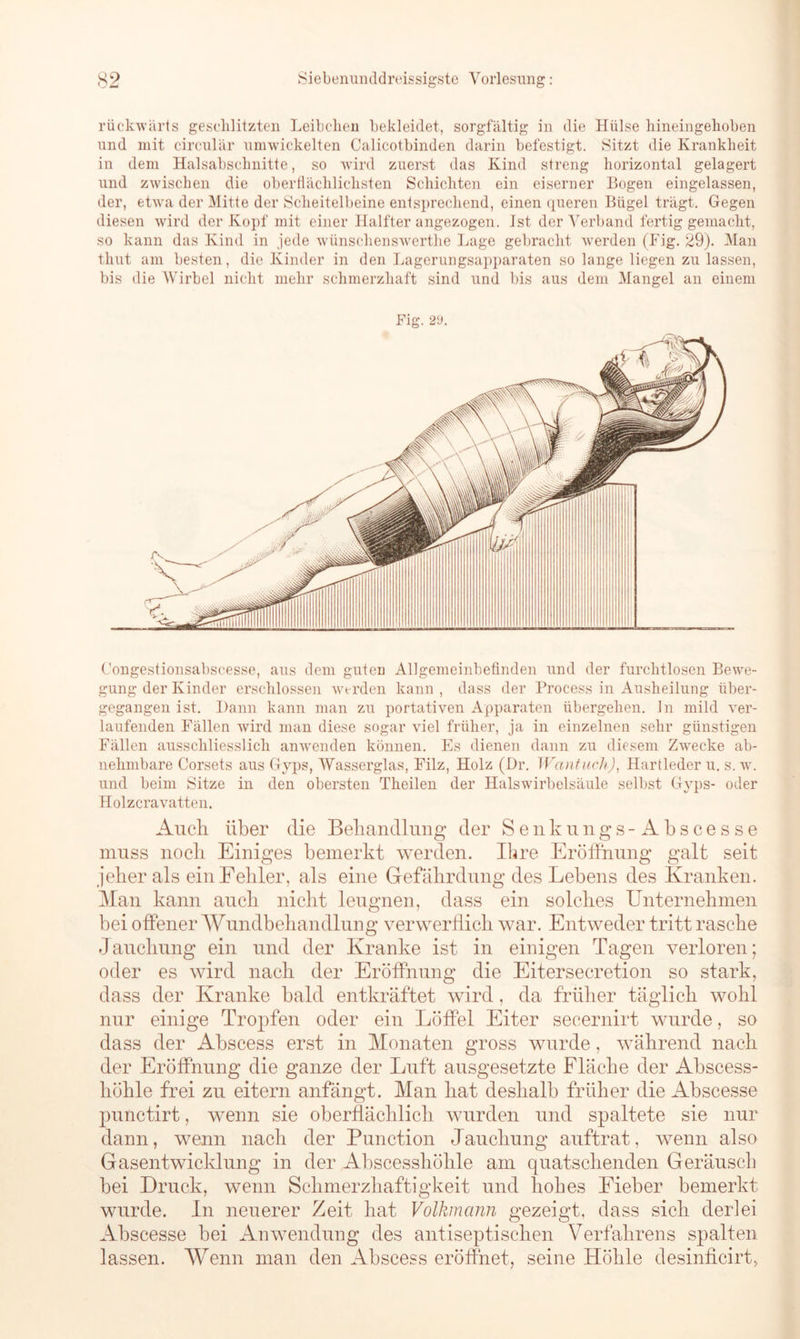 rückwärts geschlitzten Leibchen bekleidet, sorgfältig in die Hülse hineingehoben und mit circular umwickelten Calicotbinden darin befestigt. Sitzt die Krankheit in dem Halsabschnitte, so wird zuerst das Kind streng horizontal gelagert und zwischen die oberflächlichsten Schichten ein eiserner Bogen eingelassen, der, etwra der Mitte der Scheitelbeine entsprechend, einen queren Bügel trägt. Gegen diesen wird der Kopf mit einer Halfter angezogen. Ist der Verband fertig gemacht, so kann das Kind in jede wünschenswerthe Lage gebracht werden (Fig. 29). Man tliut am besten, die Kinder in den Lagerungsapparaten so lange liegen zu lassen, bis die Wirbel nicht mehr schmerzhaft sind und bis aus dem Mangel an einem Fig. 2U. Congestionsabseesse, aus dem guten Allgemeinbefinden und der furchtlosen Bewe- gung der Kinder erschlossen werden kann , dass der Process in Ausheilung über- gegangen ist. Dann kann man zu portativen Apparaten übergehen, ln mild ver- laufenden Fällen wird man diese sogar viel früher, ja in einzelnen sehr günstigen Fällen ausschliesslich anwenden können. Es dienen dann zu diesem Zwecke ab- nehmbare Corsets aus Gyps, Wasserglas, Filz, Holz (Dr. Wantuch), Hartleder u. s. wt. und beim Sitze in den obersten Tkeilen der Halswirbelsäule selbst Gyps- oder Holzcravatten. Auch über die Behandlung der Senkungs- Abscesse muss noch Einiges bemerkt werden. Ihre Eröffnung galt seit jeher als ein Fehler, als eine Gefährdung des Lebens des Kranken. Man kann auch nicht leugnen, dass ein solches Unternehmen bei offener Wundbehandlung verwerflich war. Entweder tritt rasche Jauchung ein und der Kranke ist in einigen Tagen verloren; oder es wird nach der Eröffnung die Eitersecretion so stark, dass der Kranke bald entkräftet wird, da früher täglich wohl nur einige Tropfen oder ein Löffel Eiter secernirt wurde, so dass der Abscess erst in Monaten gross wurde, während nach der Eröffnung die ganze der Luft ausgesetzte Fläche der Abscess- höhle frei zu eitern anfängt. Man hat deshalb früher die Abscesse punctirt, wenn sie oberflächlich wurden und spaltete sie nur dann, wenn nach der Punction Jauchung auftrat, wenn also Gasentwicklung in der Abscesshökle am quatschenden Geräusch bei Druck, wenn Schmerzhaftigkeit und hohes Eieber bemerkt wurde. In neuerer Zeit hat Volkmann gezeigt, dass sich derlei Abscesse bei Anwendung des antiseptischen Verfahrens spalten lassen. Wenn man den Abscess eröffnet, seine Höhle desinficirt,