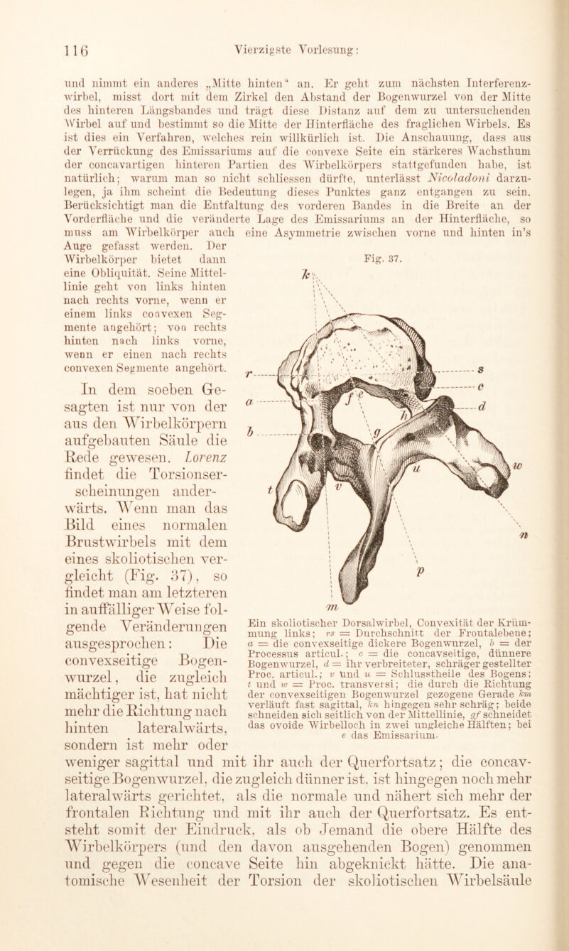 und nimmt ein anderes „Mitte hinten4 an. Er gellt zum nächsten Interferenz- wirbel, misst dort mit dem Zirkel den Abstand der Bogenwurzel von der Mitte des hinteren Längsbandes und trägt diese Distanz auf dem zu untersuchenden Wirbel auf und bestimmt so die Mitte der Hinterfläche des fraglichen Wirbels. Es ist dies ein Verfahren, welches rein willkürlich ist. Die Anschauung, dass aus der Verrückung des Emissariums auf die convexe Seite ein stärkeres Wachsthum der concavartigen hinteren Partien des Wirbelkörpers stattgefunden habe, ist natürlich; warum man so nicht schliessen dürfte, unterlässt Nicoladoni darzu- legen, ja ihm scheint die Bedeutung dieses Punktes ganz entgangen zu sein. Berücksichtigt man die Entfaltung des vorderen Bandes in die Breite an der Vorderfläche und die veränderte Lage des Emissariums an der Hinterfläche, so muss am Wirbelkörper auch eine Asymmetrie zwischen vorne und hinten in’s Auge gefasst werden. Der Wirbelkörper bietet dann Fig. 37. eine Obliquität. Seine Mittel- linie geht von links hinten nach rechts vorne, wenn er einem links convexen Seg- mente angehört; von rechts hinten nach links vorne, wenn er einen nach rechts convexen Segmente angehört. In dem soeben Ge- sagten ist nur von der aus den Wirbelkörpern aufgebauten Säule die Rede gewesen. Lorenz findet die Torsionser- scheinungen ander- wärts. Wenn man das Bild eines normalen Brustwirbels mit dem eines skoliotischen ver- gleicht (Fig. 37), so findet man am letzteren in auffälliger Weise fol- gende Veränderungen ausgesprochen: Die convexseitige Bogen- wurzel , die zugleich mächtiger ist, hat nicht mehr die Richtung nach hinten lateralwärts, Ein skoliotischer Dorsalwirbel, Convexität der Krüm- mung links; rs = Durchschnitt der Frontalebene; a = die convexseitige dickere Bogenwurzel, b = der Processus articul.; c = die concavseitige, dünnere Bogenwurzel, d = ihr verbreiteter, schräger gestellter Proc. articul.; v und u — Schlusstheile des Bogens; t und w — Proc. transversi; die durch die Richtung der convexseitigen Bogenwurzel gezogene Gerade km verläuft fast sagittal, kn hingegen sehr schräg; beide schneiden sich seitlich von der Mittellinie, gf schneidet das ovoide Wirbelloch in zwei ungleiche Hälften; bei . e das Emissarium. sondern ist mehr oder weniger sagittal und mit ihr auch der Querfortsatz; die concav- seitige Bogen-wurzel, die zugleich dünner ist. ist hingegen noch mehr lateralwärts gerichtet, als die normale und nähert sich mehr der frontalen Richtung und mit ihr auch der Querfortsatz. Es ent- steht somit der Eindruck, als ob Jemand die obere Hälfte des Wirbelkörpers (und den davon ausgehenden Bogen) genommen und gegen die concave Seite hin abgeknickt hätte. Die ana- tomische Wesenheit der Torsion der skoliotischen Wirbelsäule
