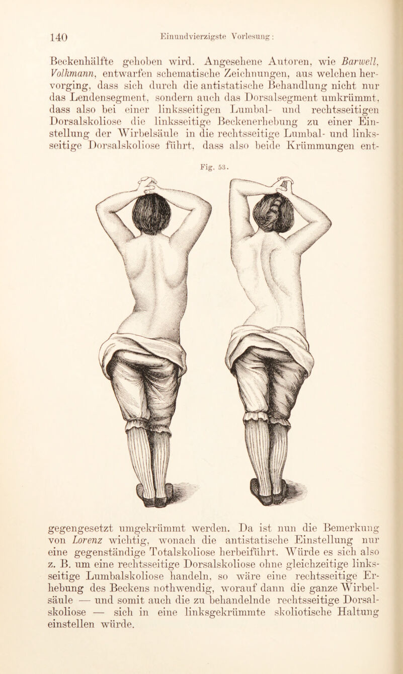 Beckenhälfte gehoben wird. Angesehene Autoren, wie Barwell, Volkmann, entwarfen schematische Zeichnungen, aus welchen her- vorging, dass sich durch die antistatische Behandlung nicht nur das Lendensegment, sondern auch das Dorsalsegment umkrümmt, dass also bei einer linksseitigen Lumbal- und rechtsseitigen Dorsalskoliose die linksseitige Beckenerhebung zu einer Ein- stellung der Wirbelsäule in die rechtsseitige Lumbal- und links- seitige Dorsalskoliose führt, dass also beide Krümmungen ent- Fig. 53. gegengesetzt umgekrümmt werden. Da ist nun die Bemerkung von Lorenz wichtig, wonach die antistatische Einstellung nur eine gegenständige Totalskoliose herbeiführt. Würde es sich also z. B. um eine rechtsseitige Dorsalskoliose ohne gleichzeitige links- seitige Lumbalskoliose handeln, so wäre eine rechtsseitige Er- hebung des Beckens nothwendig, worauf dann die ganze Wirbel- säule — und somit auch die zu behandelnde rechtsseitige Dorsal- skoliose — sich in eine linksgekrümmte skoliotische Haltung einstellen würde.