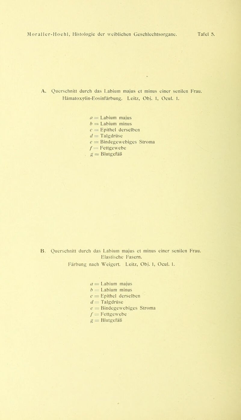 A. Querschnitt durch das Labium majus et minus einer senilen Frau. Hämatoxylin-Eosinfärbung. Leitz, Obj. 1, Ocul. 1. a = Labium majus b — Labium minus c = Epithel derselben d = Talgdrüse e = Bindegewebiges Stroma /'= Fettgewebe g — Blutgefäß B. Querschnitt durch das Labium majus et minus einer senilen Frau. Elastische Fasern. Färbung nach Weigert. Leitz, Obj. 1, Ocul. 1. a — Labium majus b = Labium minus c = Epithel derselben d = Talgdrüse e = Bindegewebiges Stroma /' = Fettgewebe g — Blutgefäß