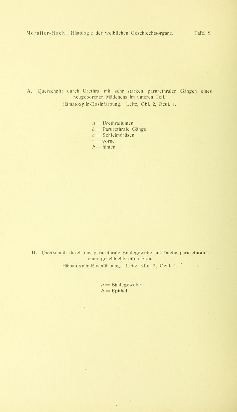 A. Querschnitt durch Urethra mit sehr starken parurethralen Gängen eines neugeborenen Mädchens im unteren Teil. Hämatoxplin-Eosinfärbung. Leitz, Obj. 2, Ocul. 1. a == Urethrallumen b = Parurethrale Gänge c = Schleimdrüsen v — vorne h = hinten B. Querschnitt durch das parurethrale Bindegewebe mit Ductus parurethrales einer geschlechtsreifen Frau. Hämatoxvlin-Eosinfärbung. Leitz, Obj. 2, Ocul. 1. a— Bindegewebe b — Epithel