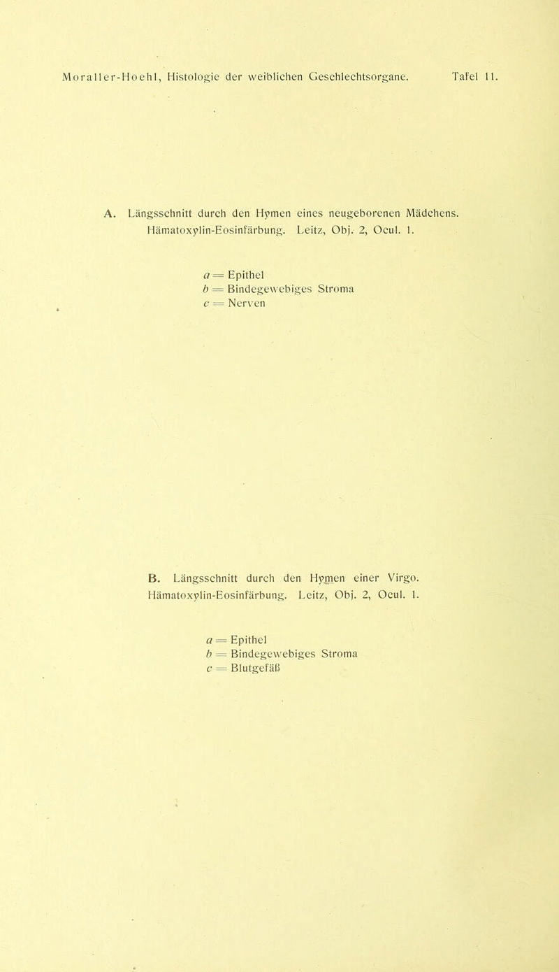 A. Längsschnitt durch den Hymen eines neugeborenen Mädchens. Hämatoxylin-Eosinfärbung. Leitz, Obj. 2, Ocul. 1. a= Epithel b = Bindegewebiges Stroma c = Nerven B. Längsschnitt durch den Hymen einer Virgo. Hämatoxylin-Eosinfärbung. Leitz, Obj. 2, Ocul. 1. o= Epithel b = Bindegewebiges Stroma c -- Blutgefäß