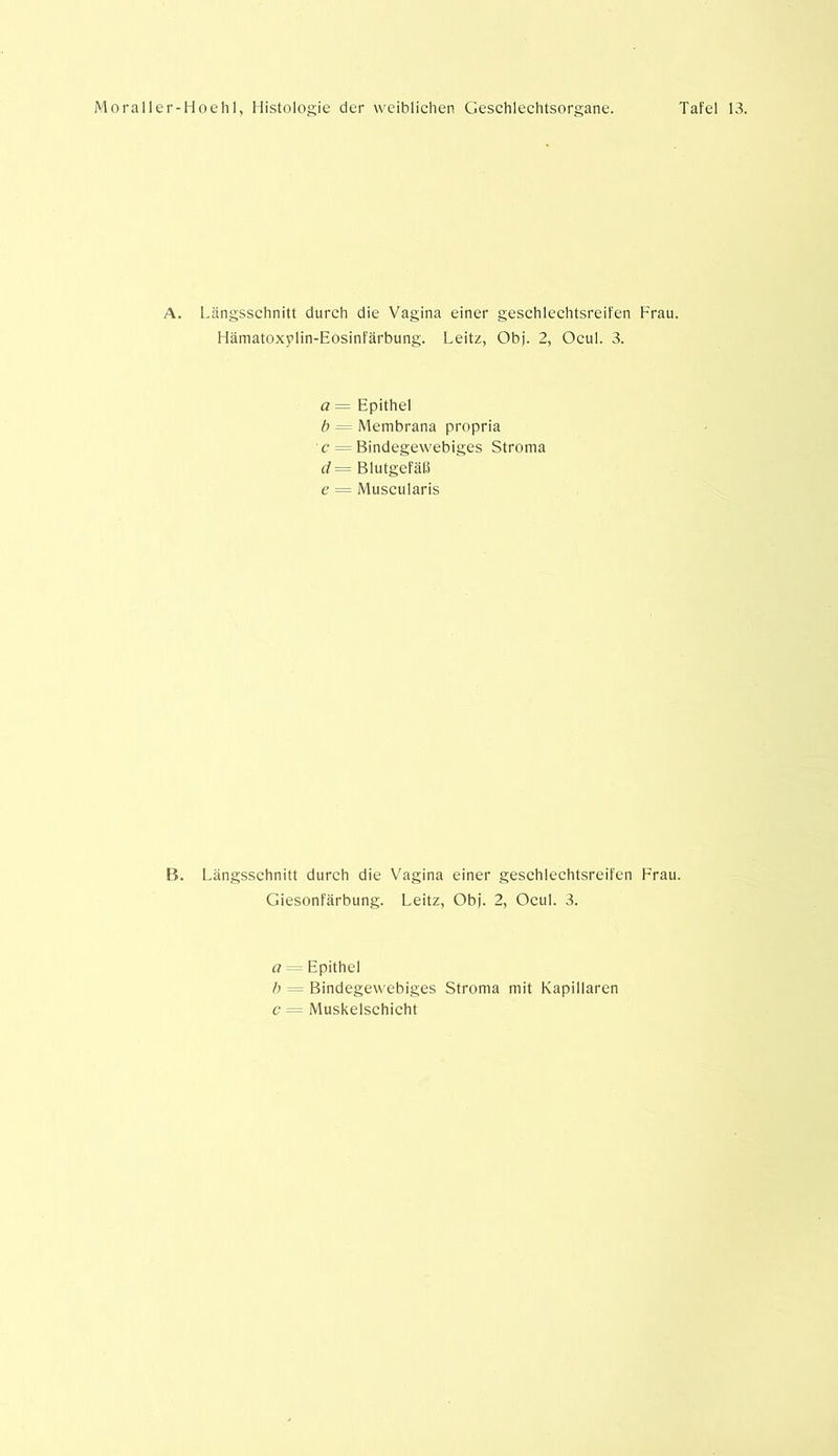 A. Längsschnitt durch die Vagina einer geschlechtsreifen Frau. Hämatoxplin-Eosinfärbung. Leitz, Obj. 2, Ocul. 3. a = Epithel b = Membrana propria c = Bindegewebiges Stroma d = Blutgefäß e = Muscularis B. 1 Längsschnitt durch die Vagina einer geschlechtsreifen Frau. Giesonfärbung. Leitz, Obj. 2, Ocul. 3. a Epithel b = Bindegewebiges Stroma mit Kapillaren c = Muskelschicht