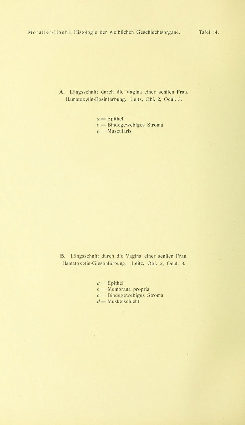 A. Längsschnitt durch die Vagina einer senilen Frau. Hämatoxylin-Eosinfärbung. Leitz, Ob). 2, Ocul. 3. a — Epithel b = Bindegewebiges Stroma c = Muscularis B. Längsschnitt durch die Vagina einer senilen Frau. Hämatoxylin-Giesonfärbung. Leitz, Obj. 2, Ocul. 3. a = Epithel b = Membrana propria c = Bindegewebiges Stroma d— Muskelschicht