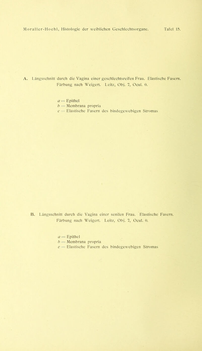 A. Längsschnitt durch die Vagina einer geschlechtsreifen Frau. Elastische Fasern. Färbung nach Weigert. I.eitz, Ob). 7, Ocul. 0. a= Epithel b = Membrana propria c = Elastische Fasern des bindegewebigen Stromas B. Längsschnitt durch die Vagina einer senilen Frau. Elastische Fasern. Färbung nach Weigert. Leitz, Ob). 7, Ocul. 0. a = Epithel b = Membrana propria c = Elastische Fasern des bindegewebigen Stromas