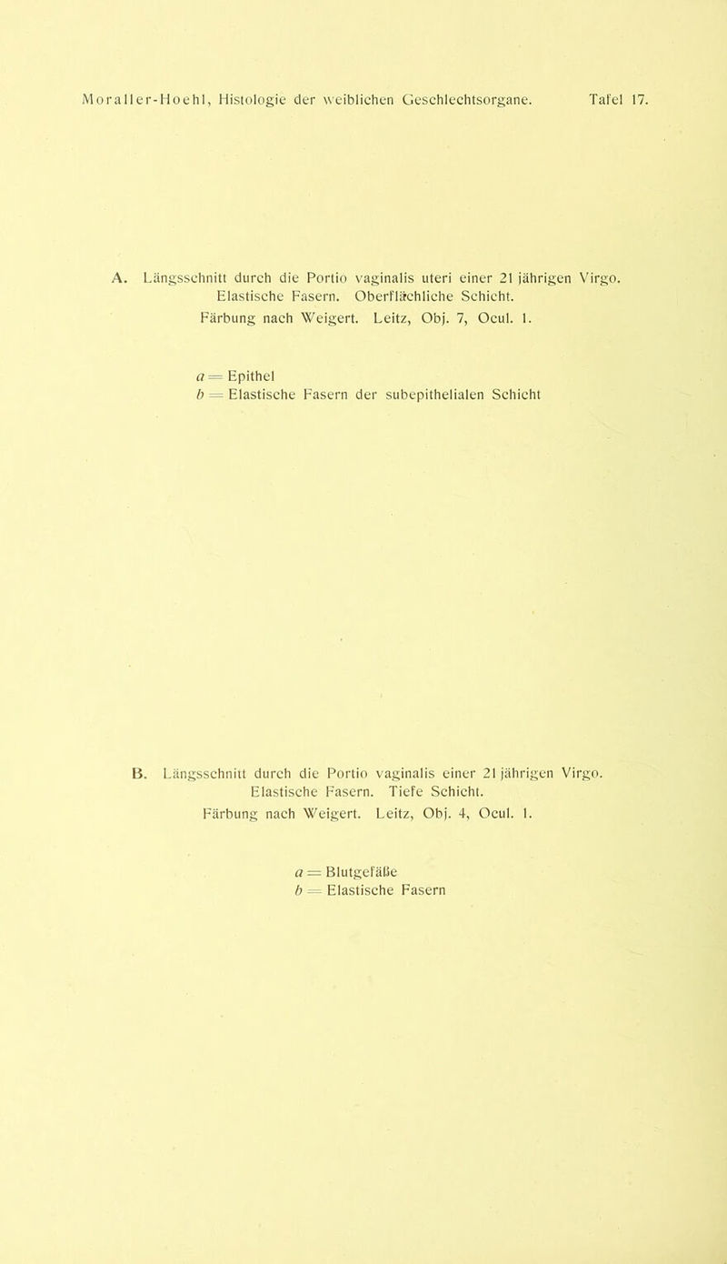A. Längsschnitt durch die Portio vaginalis Uteri einer 21 jährigen Virgo. Elastische Fasern. Oberflächliche Schicht. Färbung nach Weigert. Leitz, Obj. 7, Ocul. 1. a = Epithel b — Elastische Fasern der subepithelialen Schicht B. Längsschnitt durch die Portio vaginalis einer 21jährigen Virgo. Elastische Fasern. Tiefe Schicht. Färbung nach Weigert. Leitz, Obj. 4, Ocul. 1. a = Blutgefäße b = Elastische Fasern